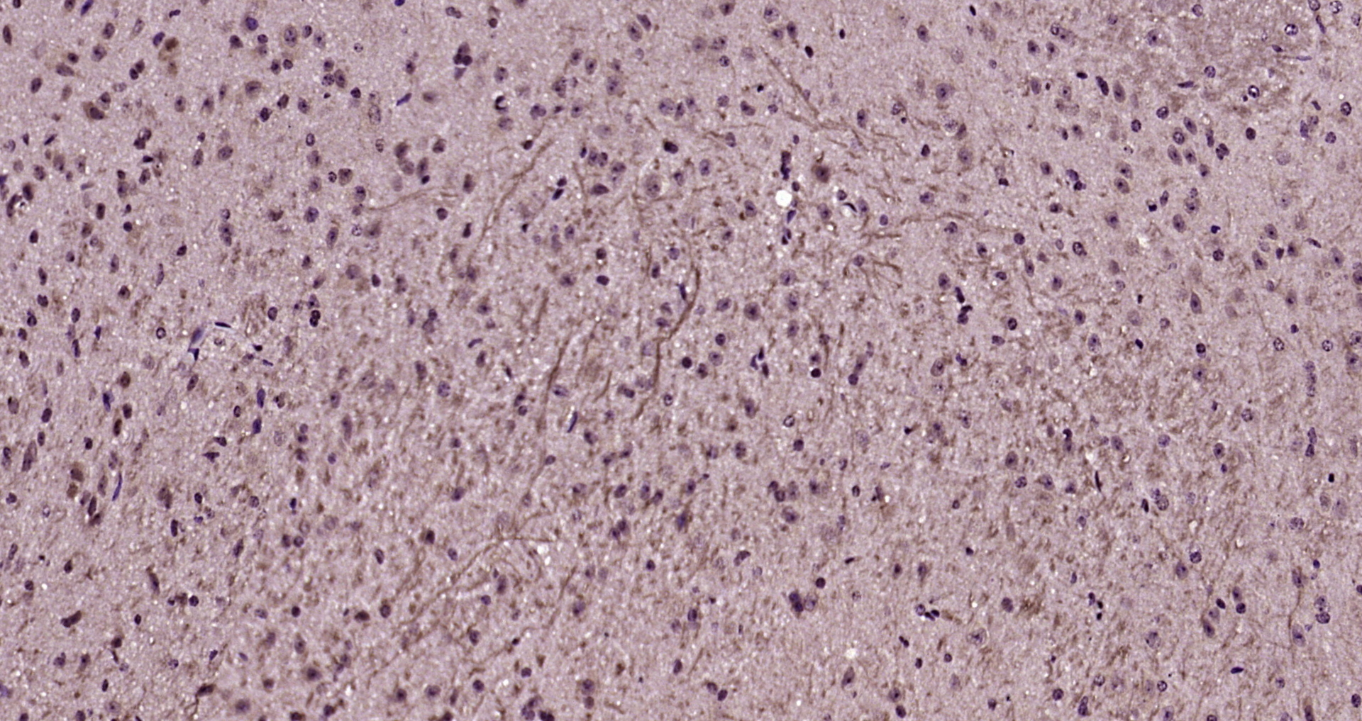 Paraformaldehyde-fixed, paraffin embedded Mouse brain; Antigen retrieval by boiling in sodium citrate buffer (pH6.0) for 15min; Block endogenous peroxidase by 3% hydrogen peroxide for 20 minutes; Blocking buffer (normal goat serum) at 37°C for 30min; Antibody incubation with SRPX2 Polyclonal Antibody, Unconjugated (bs-11967R) at 1:200 overnight at 4°C, DAB staining.