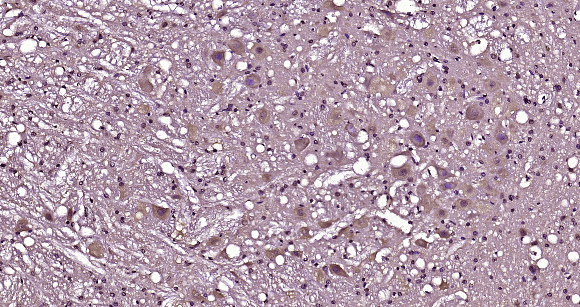 Paraformaldehyde-fixed, paraffin embedded Rat brain; Antigen retrieval by boiling in sodium citrate buffer (pH6.0) for 15min; Block endogenous peroxidase by 3% hydrogen peroxide for 20 minutes; Blocking buffer (normal goat serum) at 37°C for 30min; Antibody incubation with NCS1/Frequenin Polyclonal Antibody, Unconjugated (bs-11977R) at 1:200 overnight at 4°C, DAB staining.