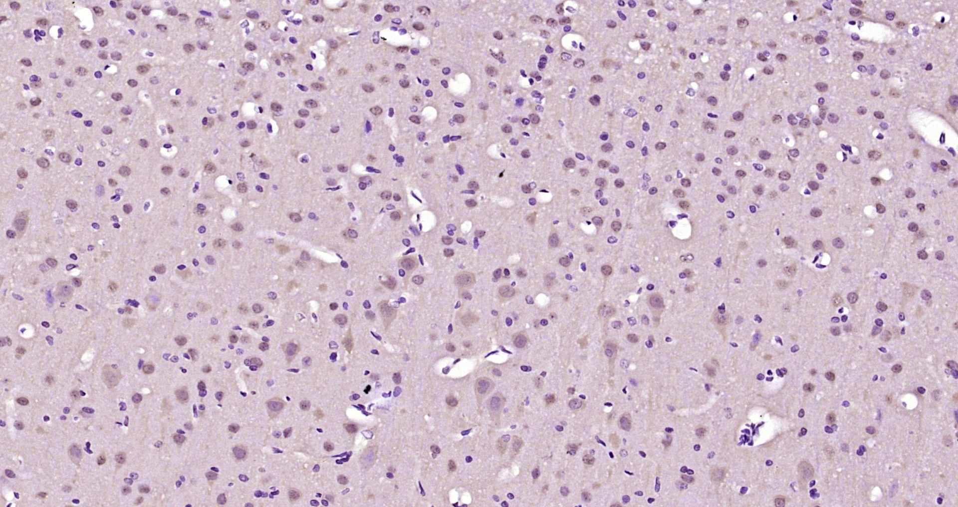 Paraformaldehyde-fixed, paraffin embedded Rat brain; Antigen retrieval by boiling in sodium citrate buffer (pH6.0) for 15min; Block endogenous peroxidase by 3% hydrogen peroxide for 20 minutes; Blocking buffer (normal goat serum) at 37°C for 30min; Antibody incubation with SHANK3 Polyclonal Antibody, Unconjugated (bs-12143R) at 1:200 overnight at 4°C, DAB staining.