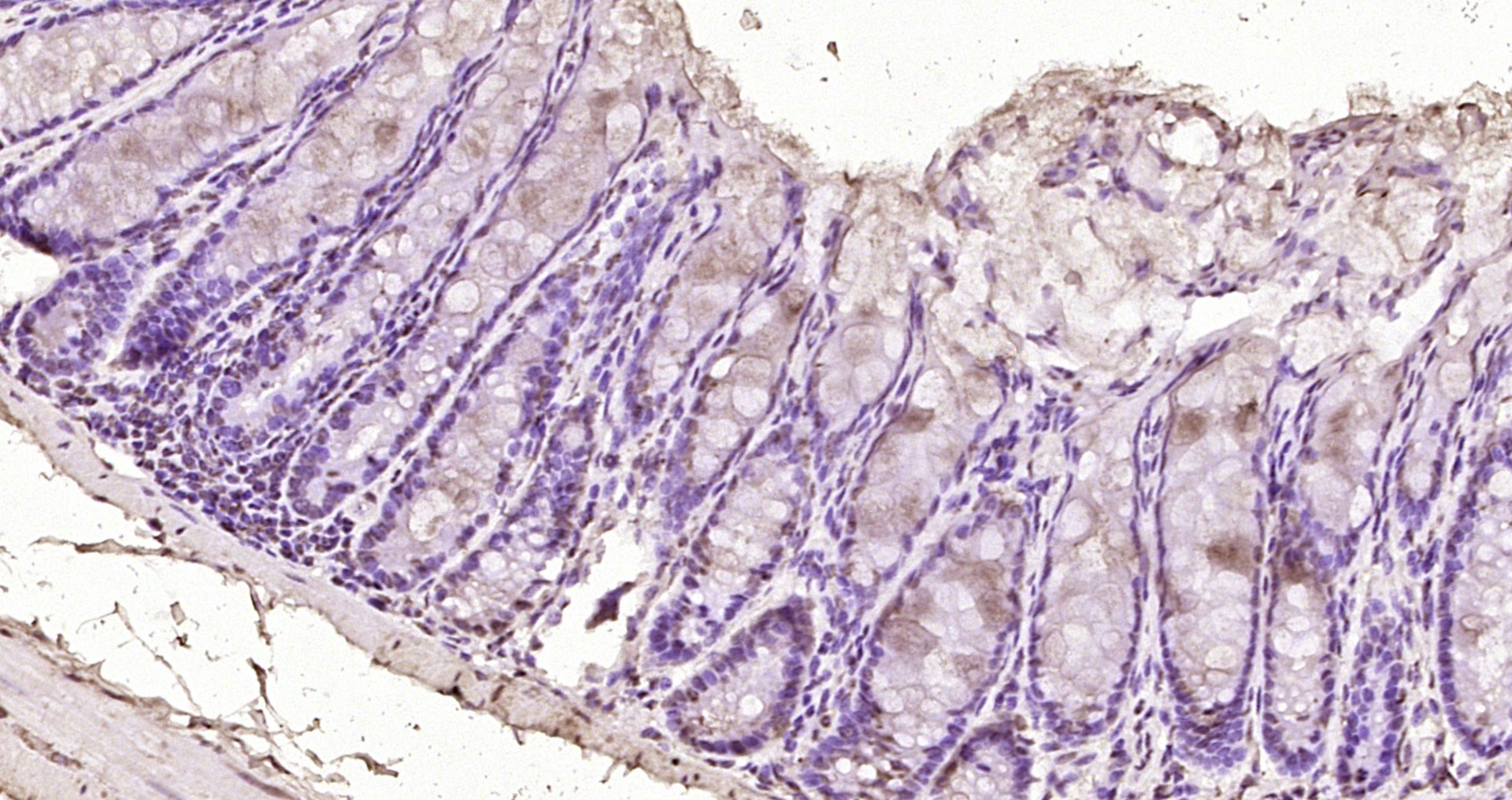 Paraformaldehyde-fixed, paraffin embedded Mouse colon; Antigen retrieval by boiling in sodium citrate buffer (pH6.0) for 15min; Block endogenous peroxidase by 3% hydrogen peroxide for 20 minutes; Blocking buffer (normal goat serum) at 37°C for 30min; Antibody incubation with SOX7 Polyclonal Antibody, Unconjugated (bs-12277R) at 1:200 overnight at 4°C, DAB staining.