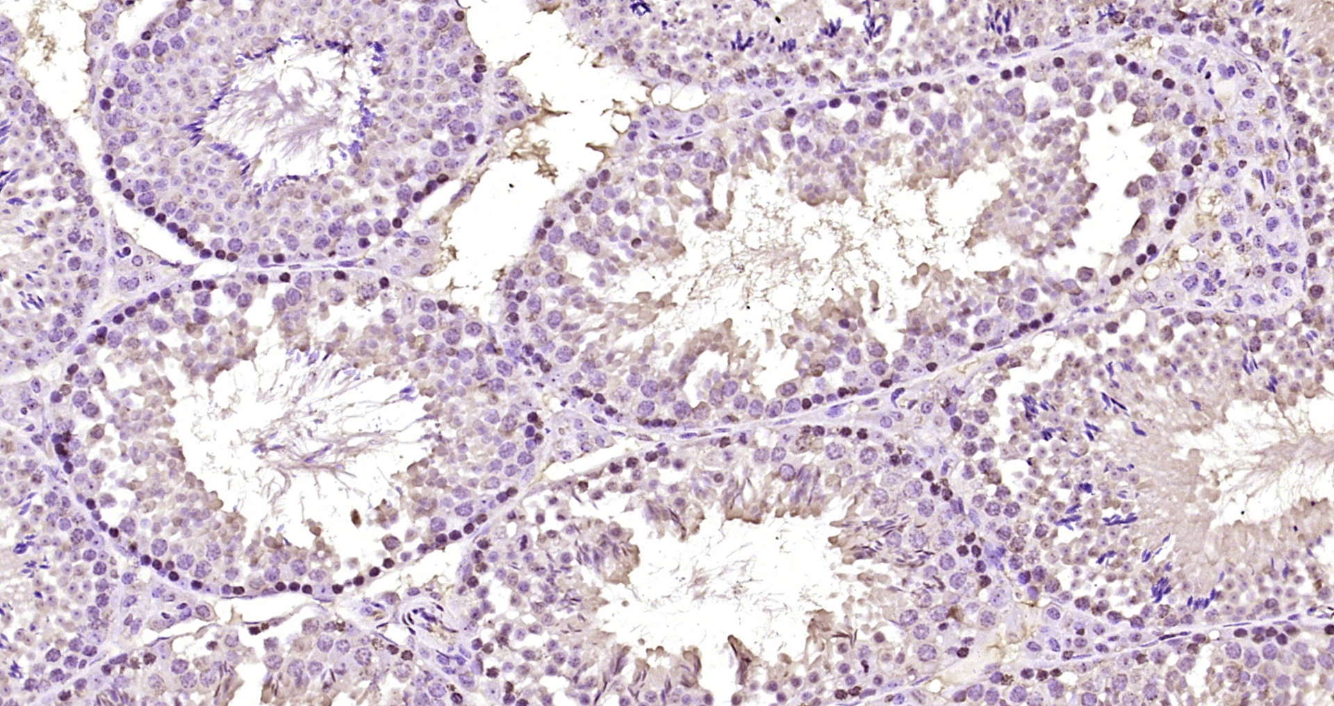 Paraformaldehyde-fixed, paraffin embedded Mouse testis; Antigen retrieval by boiling in sodium citrate buffer (pH6.0) for 15min; Block endogenous peroxidase by 3% hydrogen peroxide for 20 minutes; Blocking buffer (normal goat serum) at 37°C for 30min; Antibody incubation with SOX7 Polyclonal Antibody, Unconjugated (bs-12277R) at 1:200 overnight at 4°C, DAB staining.