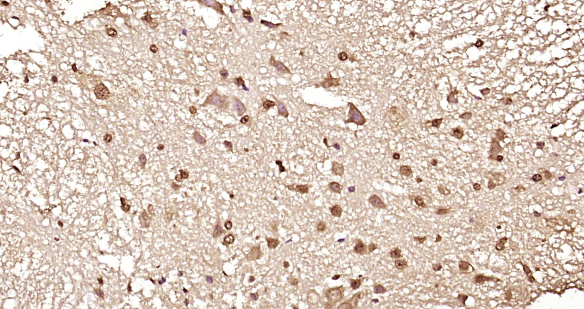 Paraformaldehyde-fixed, paraffin embedded Mouse spinal cord; Antigen retrieval by boiling in sodium citrate buffer (pH6.0) for 15min; Block endogenous peroxidase by 3% hydrogen peroxide for 20 minutes; Blocking buffer (normal goat serum) at 37°C for 30min; Antibody incubation with _x000D_ Ataxin 1(Ser775) Polyclonal Antibody, Unconjugated (bs-12534R) at 1:200 overnight at 4°C, DAB staining.