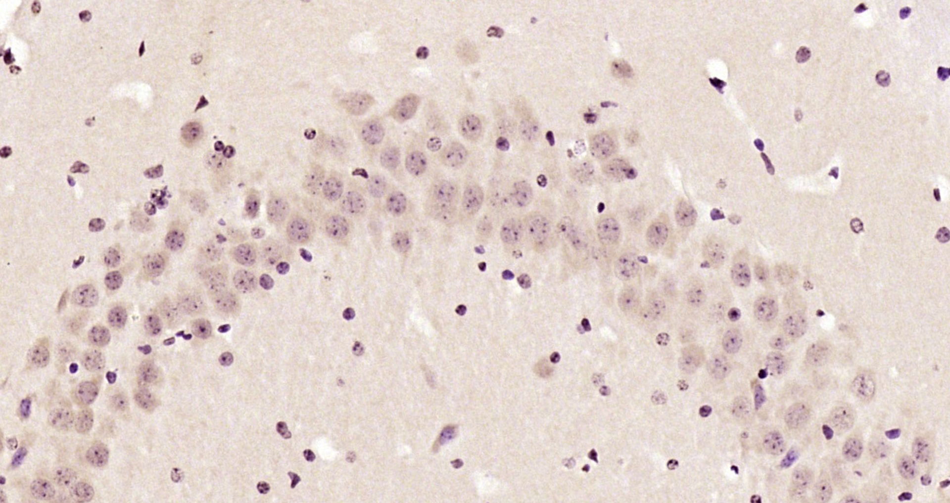 Paraformaldehyde-fixed, paraffin embedded Mouse brain; Antigen retrieval by boiling in sodium citrate buffer (pH6.0) for 15min; Block endogenous peroxidase by 3% hydrogen peroxide for 20 minutes; Blocking buffer (normal goat serum) at 37°C for 30min; Antibody incubation with _x000D_ Ataxin 1(Ser775) Polyclonal Antibody, Unconjugated (bs-12534R) at 1:200 overnight at 4°C, DAB staining.