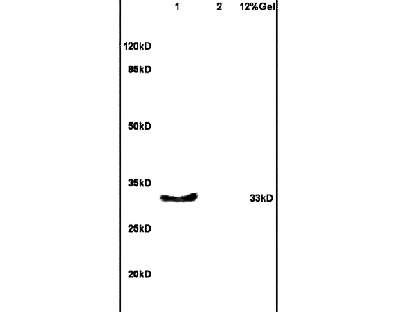 Lane 1: mouse embryo lysates Lane 2: mouse intestine lysates probed with Anti- EKLF/KLF1, 2, 4 Polyclonal Antibody, Unconjugated (bs-9526R) at 1:200 in 4˚C. Followed by conjugation to secondary antibody (bs-0295G-HRP) at 1:3000 90min in 37˚C. Predicted band 33kD. Observed band size: 33kD