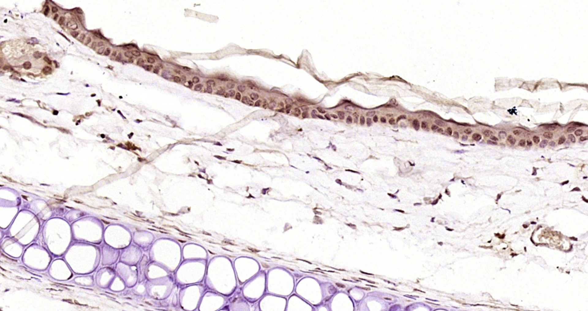 Paraformaldehyde-fixed, paraffin embedded Mouse skin; Antigen retrieval by boiling in sodium citrate buffer (pH6.0) for 15min; Block endogenous peroxidase by 3% hydrogen peroxide for 20 minutes; Blocking buffer (normal goat serum) at 37°C for 30min; Antibody incubation with EXOSC10/PMSCL2 Polyclonal Antibody, Unconjugated (bs-13120R) at 1:200 overnight at 4°C, DAB staining. Paraformaldehyde-fixed, paraffin embedded Mouse skin; Antigen retrieval by boiling in sodium citrate buffer (pH6.0) for 15min; Block endogenous peroxidase by 3% hydrogen peroxide for 20 minutes; Blocking buffer (normal goat serum) at 37°C for 30min; Antibody incubation with EXOSC10/PMSCL2 Polyclonal Antibody, Unconjugated (bs-13120R) at 1:200 overnight at 4°C, DAB staining.