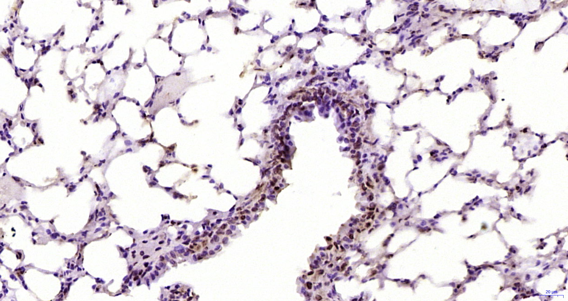 Paraformaldehyde-fixed, paraffin embedded Mouse lung; Antigen retrieval by boiling in sodium citrate buffer (pH6.0) for 15min; Block endogenous peroxidase by 3% hydrogen peroxide for 20 minutes; Blocking buffer (normal goat serum) at 37°C for 30min; Antibody incubation with GNL3L Polyclonal Antibody, Unconjugated (bs-13472R) at 1:200 overnight at 4°C, DAB staining. Paraformaldehyde-fixed, paraffin embedded Mouse lung; Antigen retrieval by boiling in sodium citrate buffer (pH6.0) for 15min; Block endogenous peroxidase by 3% hydrogen peroxide for 20 minutes; Blocking buffer (normal goat serum) at 37°C for 30min; Antibody incubation with GNL3L Polyclonal Antibody, Unconjugated (bs-13472R) at 1:200 overnight at 4°C, DAB staining.