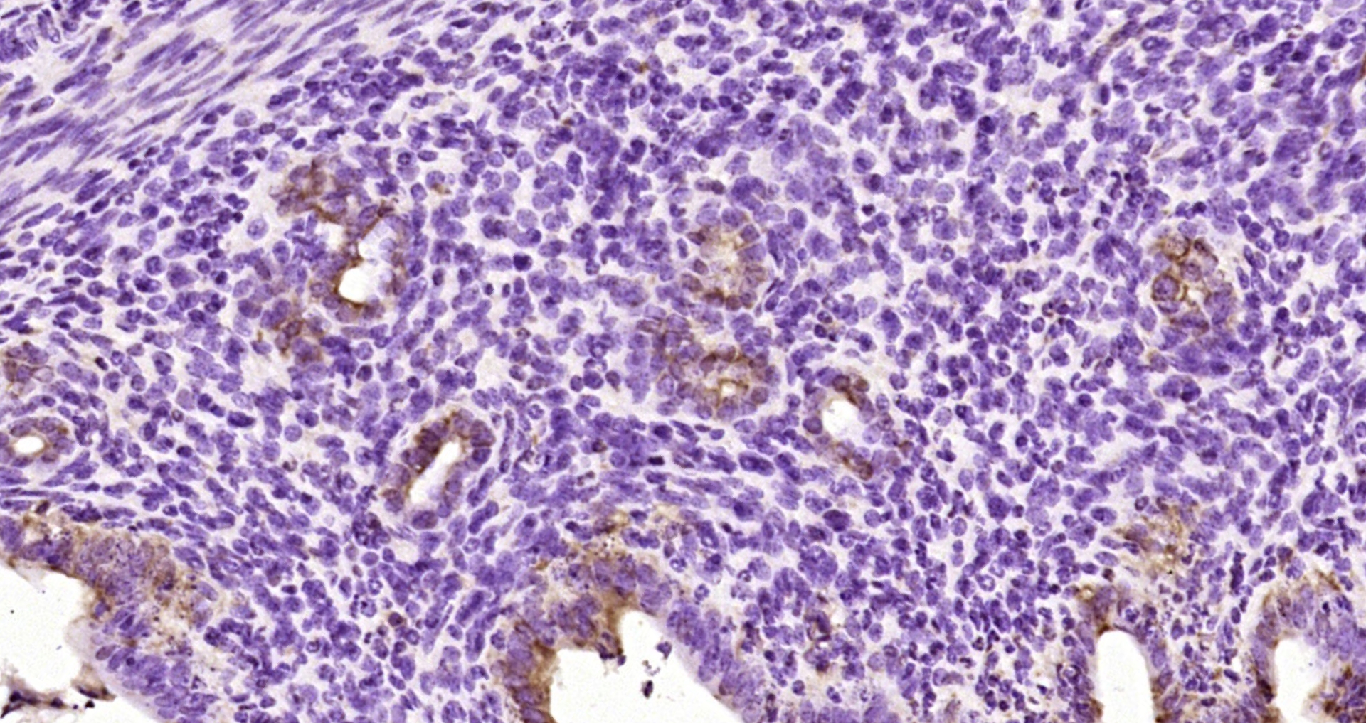 Paraformaldehyde-fixed, paraffin embedded Mouse uterus; Antigen retrieval by boiling in sodium citrate buffer (pH6.0) for 15min; Block endogenous peroxidase by 3% hydrogen peroxide for 20 minutes; Blocking buffer (normal goat serum) at 37°C for 30min; Antibody incubation with ZNF503/NOLZ1 Polyclonal Antibody, Unconjugated (bs-13587R) at 1:200 overnight at 4°C, DAB staining. Paraformaldehyde-fixed, paraffin embedded Mouse uterus; Antigen retrieval by boiling in sodium citrate buffer (pH6.0) for 15min; Block endogenous peroxidase by 3% hydrogen peroxide for 20 minutes; Blocking buffer (normal goat serum) at 37°C for 30min; Antibody incubation with ZNF503/NOLZ1 Polyclonal Antibody, Unconjugated (bs-13587R) at 1:200 overnight at 4°C, DAB staining.