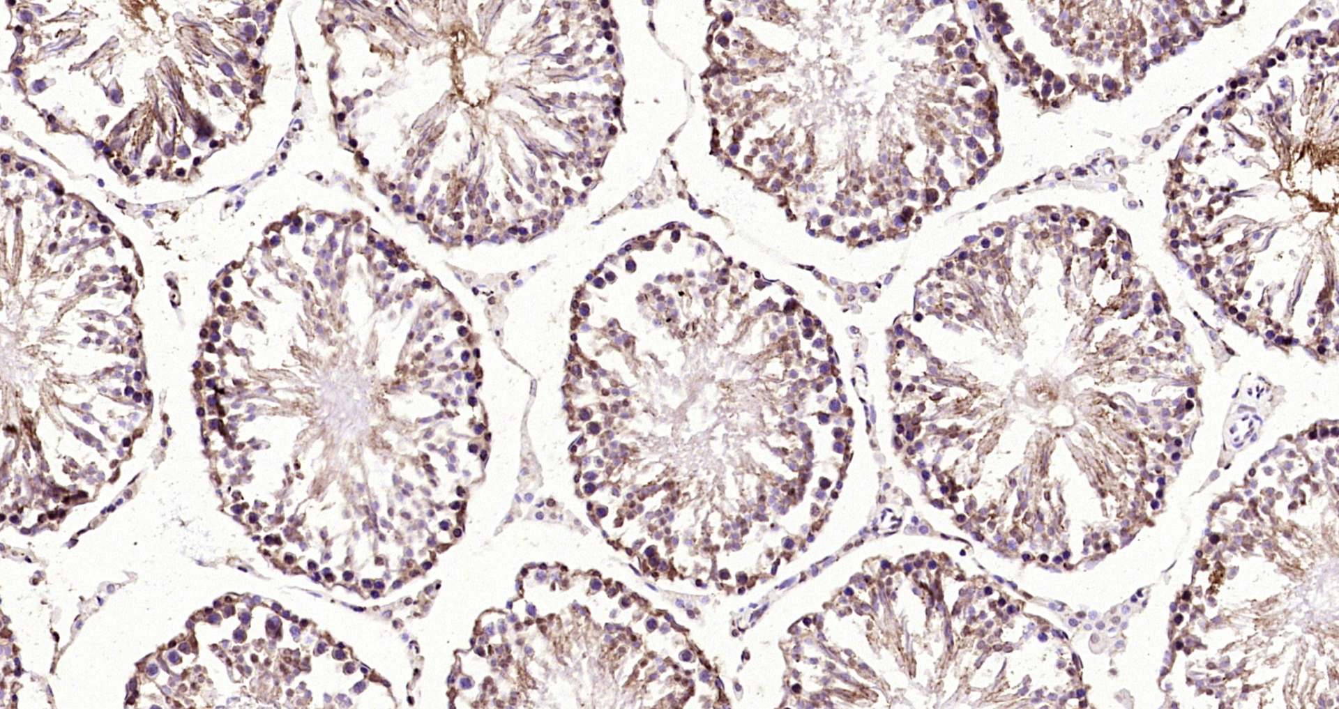 Paraformaldehyde-fixed, paraffin embedded Rat testis; Antigen retrieval by boiling in sodium citrate buffer (pH6.0) for 15min; Block endogenous peroxidase by 3% hydrogen peroxide for 20 minutes; Blocking buffer (normal goat serum) at 37°C for 30min; Antibody incubation with eIF4ENIF1 Polyclonal Antibody, Unconjugated (bs-14561R) at 1:200 overnight at 4°C, DAB staining.