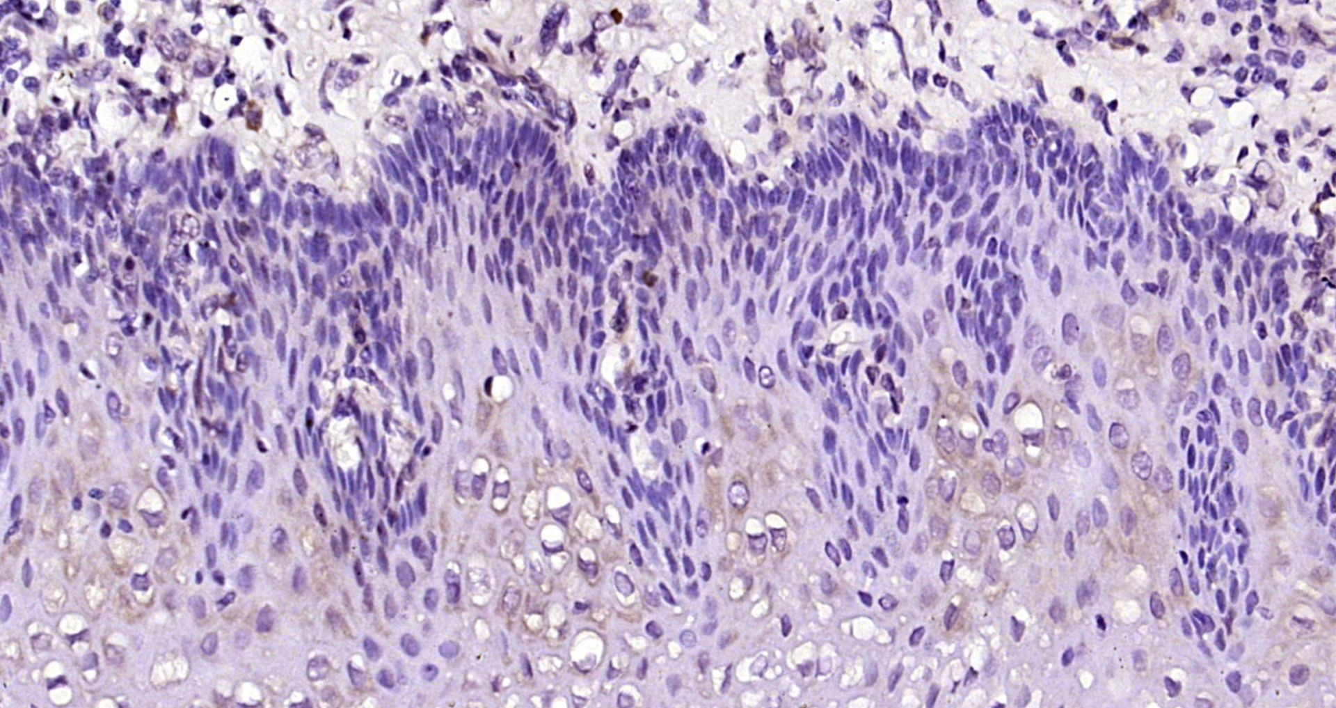 Paraformaldehyde-fixed, paraffin embedded Human esophagus; Antigen retrieval by boiling in sodium citrate buffer (pH6.0) for 15min; Block endogenous peroxidase by 3% hydrogen peroxide for 20 minutes; Blocking buffer (normal goat serum) at 37°C for 30min; Antibody incubation with C9orf169 Polyclonal Antibody, Unconjugated (bs-15318R) at 1:200 overnight at 4°C, DAB staining.