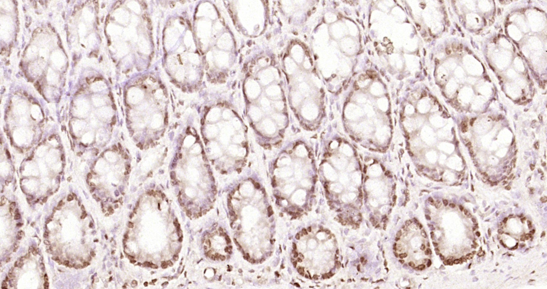 Paraformaldehyde-fixed, paraffin embedded Rat colon; Antigen retrieval by boiling in sodium citrate buffer (pH6.0) for 15min; Block endogenous peroxidase by 3% hydrogen peroxide for 20 minutes; Blocking buffer (normal goat serum) at 37°C for 30min; Antibody incubation with RGS14 Polyclonal Antibody, Unconjugated (bs-15502R) at 1:200 overnight at 4°C, DAB staining.