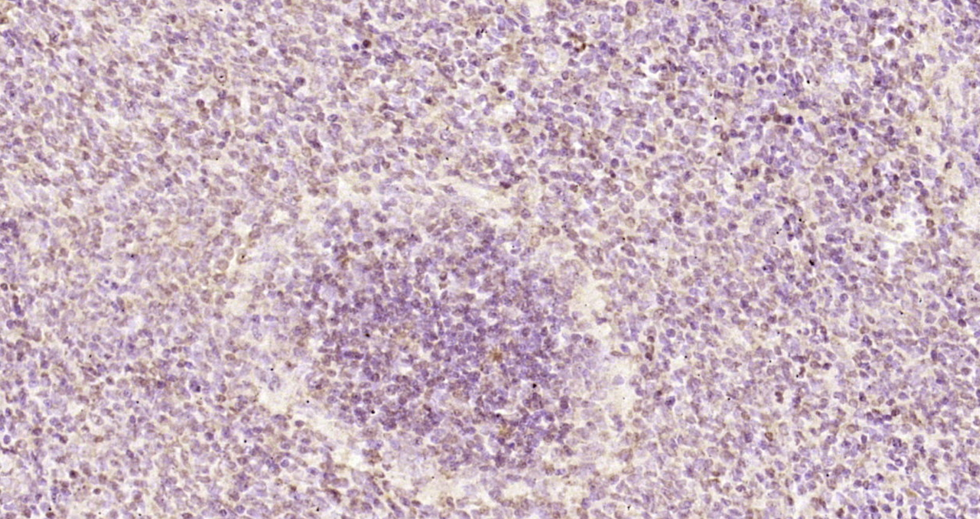 Paraformaldehyde-fixed, paraffin embedded Rat spleen; Antigen retrieval by boiling in sodium citrate buffer (pH6.0) for 15min; Block endogenous peroxidase by 3% hydrogen peroxide for 20 minutes; Blocking buffer (normal goat serum) at 37°C for 30min; Antibody incubation with RGS14 Polyclonal Antibody, Unconjugated (bs-15502R) at 1:200 overnight at 4°C, DAB staining.