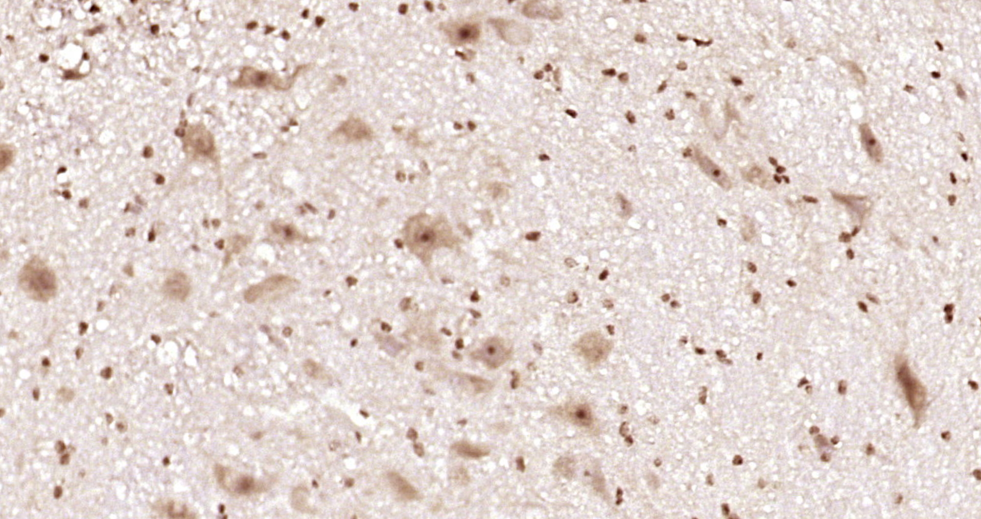 Paraformaldehyde-fixed, paraffin embedded Mouse cerebellum; Antigen retrieval by boiling in sodium citrate buffer (pH6.0) for 15min; Block endogenous peroxidase by 3% hydrogen peroxide for 20 minutes; Blocking buffer (normal goat serum) at 37°C for 30min; Antibody incubation with RGS14 Polyclonal Antibody, Unconjugated (bs-15502R) at 1:200 overnight at 4°C, DAB staining.