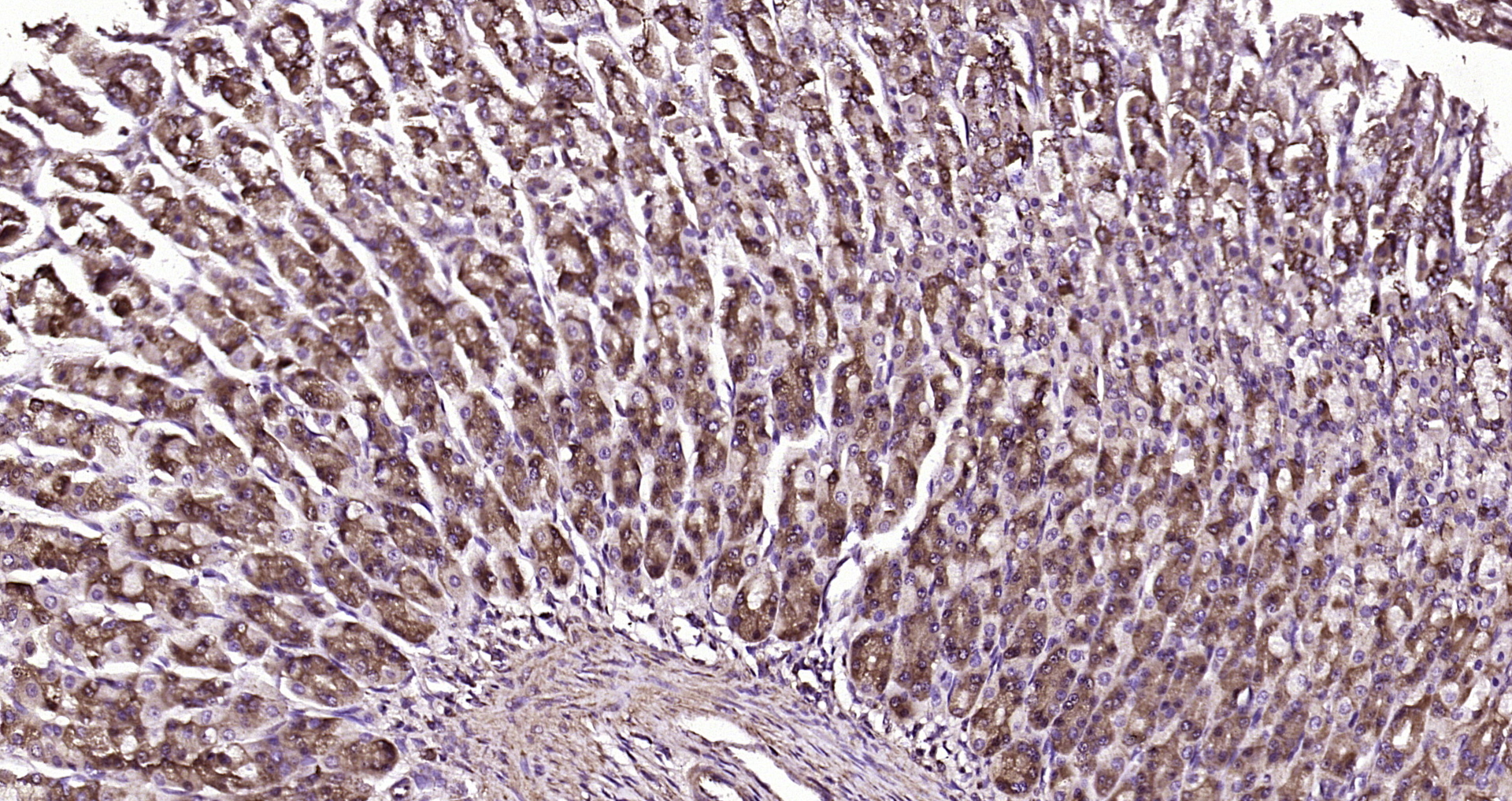 Paraformaldehyde-fixed, paraffin embedded Rat stomach; Antigen retrieval by boiling in sodium citrate buffer (pH6.0) for 15min; Block endogenous peroxidase by 3% hydrogen peroxide for 20 minutes; Blocking buffer (normal goat serum) at 37°C for 30min; Antibody incubation with ICK Polyclonal Antibody, Unconjugated (bs-15536R) at 1:200 overnight at 4°C, DAB staining.