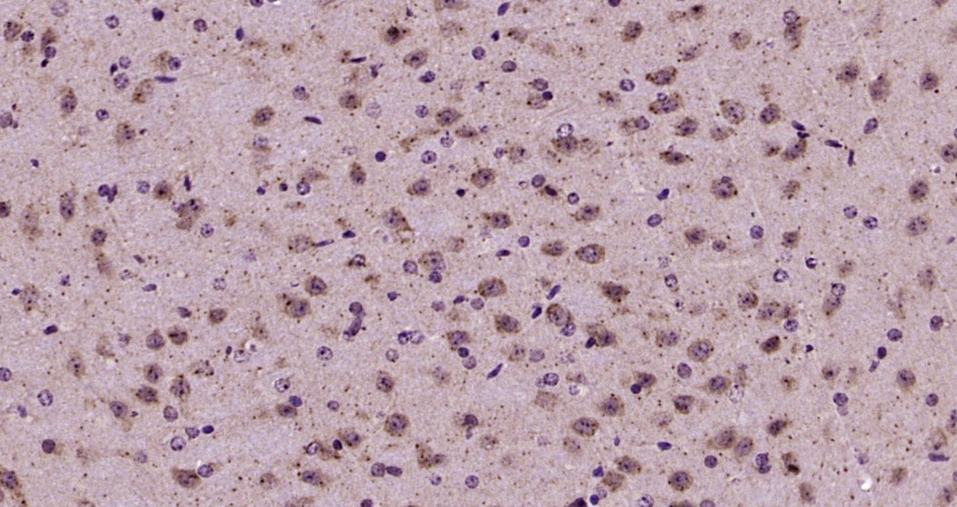 Paraformaldehyde-fixed, paraffin embedded Mouse brain; Antigen retrieval by boiling in sodium citrate buffer (pH6.0) for 15min; Block endogenous peroxidase by 3% hydrogen peroxide for 20 minutes; Blocking buffer (normal goat serum) at 37°C for 30min; Antibody incubation with ICK Polyclonal Antibody, Unconjugated (bs-15536R) at 1:200 overnight at 4°C, DAB staining.