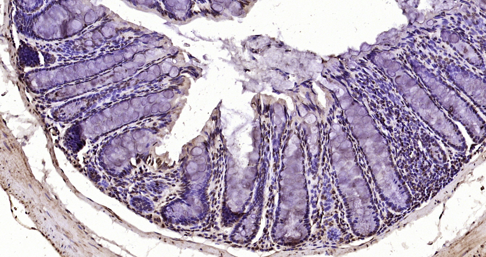 Paraformaldehyde-fixed, paraffin embedded Mouse colon; Antigen retrieval by boiling in sodium citrate buffer (pH6.0) for 15min; Block endogenous peroxidase by 3% hydrogen peroxide for 20 minutes; Blocking buffer (normal goat serum) at 37°C for 30min; Antibody incubation with Pan-Histone H3 Polyclonal Antibody, Unconjugated (bs-17422R) at 1:200 overnight at 4°C, DAB staining. Paraformaldehyde-fixed, paraffin embedded Mouse colon; Antigen retrieval by boiling in sodium citrate buffer (pH6.0) for 15min; Block endogenous peroxidase by 3% hydrogen peroxide for 20 minutes; Blocking buffer (normal goat serum) at 37°C for 30min; Antibody incubation with Pan-Histone H3 Polyclonal Antibody, Unconjugated (bs-17422R) at 1:200 overnight at 4°C, DAB staining.