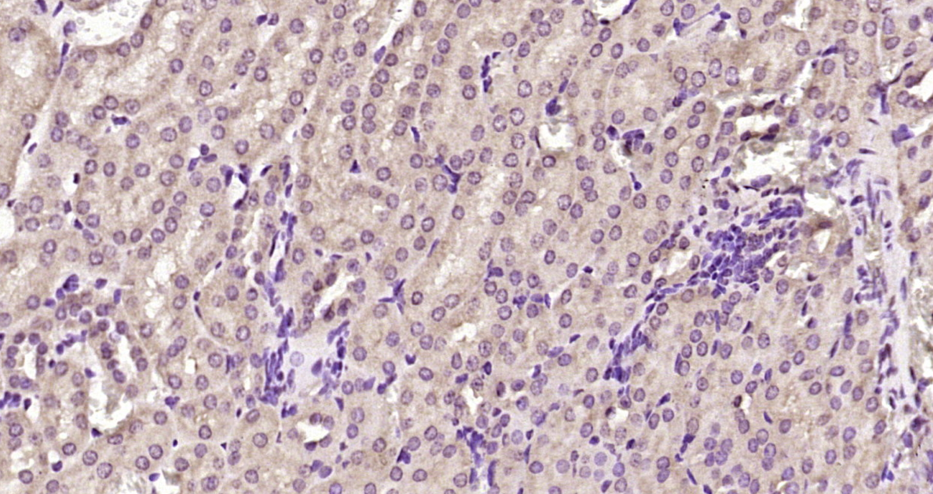 Paraformaldehyde-fixed, paraffin embedded Mouse kidney; Antigen retrieval by boiling in sodium citrate buffer (pH6.0) for 15min; Block endogenous peroxidase by 3% hydrogen peroxide for 20 minutes; Blocking buffer (normal goat serum) at 37°C for 30min; Antibody incubation with MTA3 Polyclonal Antibody, Unconjugated (bs-20028R) at 1:200 overnight at 4°C, DAB staining.