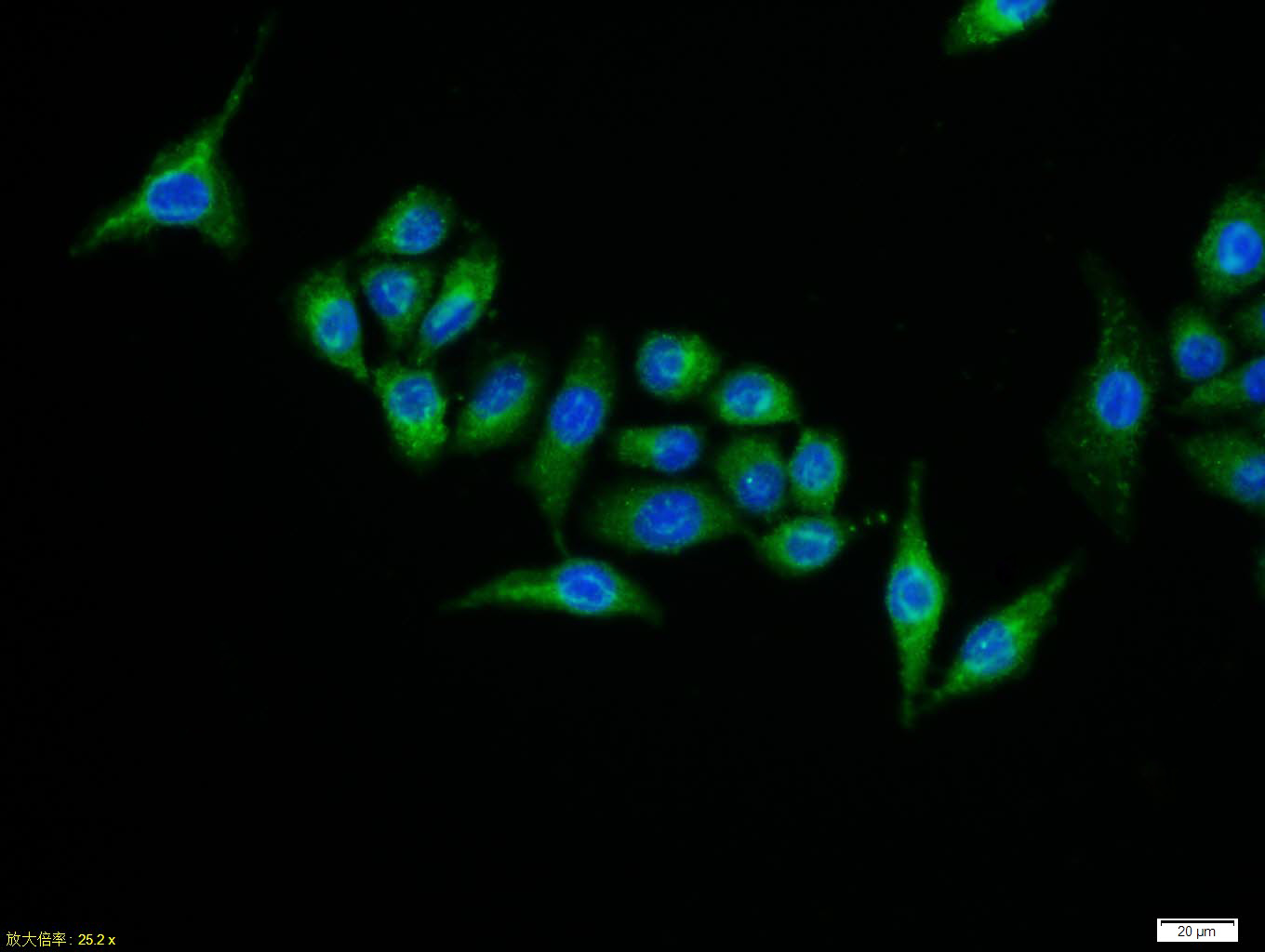 Tissue/cell:MCF7 cell; 4% Paraformaldehyde-fixed; Triton X-100 at room temperature for 20 min; Blocking buffer (normal goat serum, C-0005) at 37°C for 20 min; Antibody incubation with (IASPP) polyclonal Antibody, Unconjugated (bs-0284R) 1:100, 90 minutes at 37°C; followed by a FITC conjugated Goat Anti-Rabbit IgG antibody at 37°C for 90 minutes, DAPI (blue, C02-04002) was used to stain the cell nuclei.