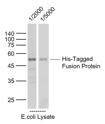 His-Tagged Fusion Protein Overexpression E.coli Lysate (Cat#: bs-41403P) at 4 ug_x000D_ Primary: Anti-His Tag (bs-10582R) at 1/2000 ~ 1/5000 dilution_x000D_ Secondary: IRDye800CW Goat Anti-Rabbit IgG at 1/20000 dilution