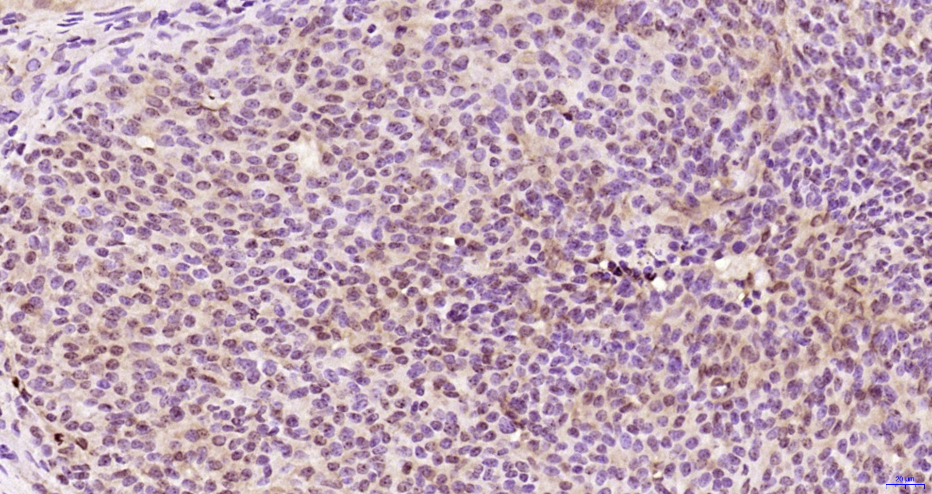 Paraformaldehyde-fixed, paraffin embedded Rat ovarian; Antigen retrieval by boiling in sodium citrate buffer (pH6.0) for 15min; Block endogenous peroxidase by 3% hydrogen peroxide for 20 minutes; Blocking buffer (normal goat serum) at 37°C for 30min; Antibody incubation with KRG2/DDX11 Polyclonal Antibody, Unconjugated (bs-22217R) at 1:200 overnight at 4°C, DAB staining.