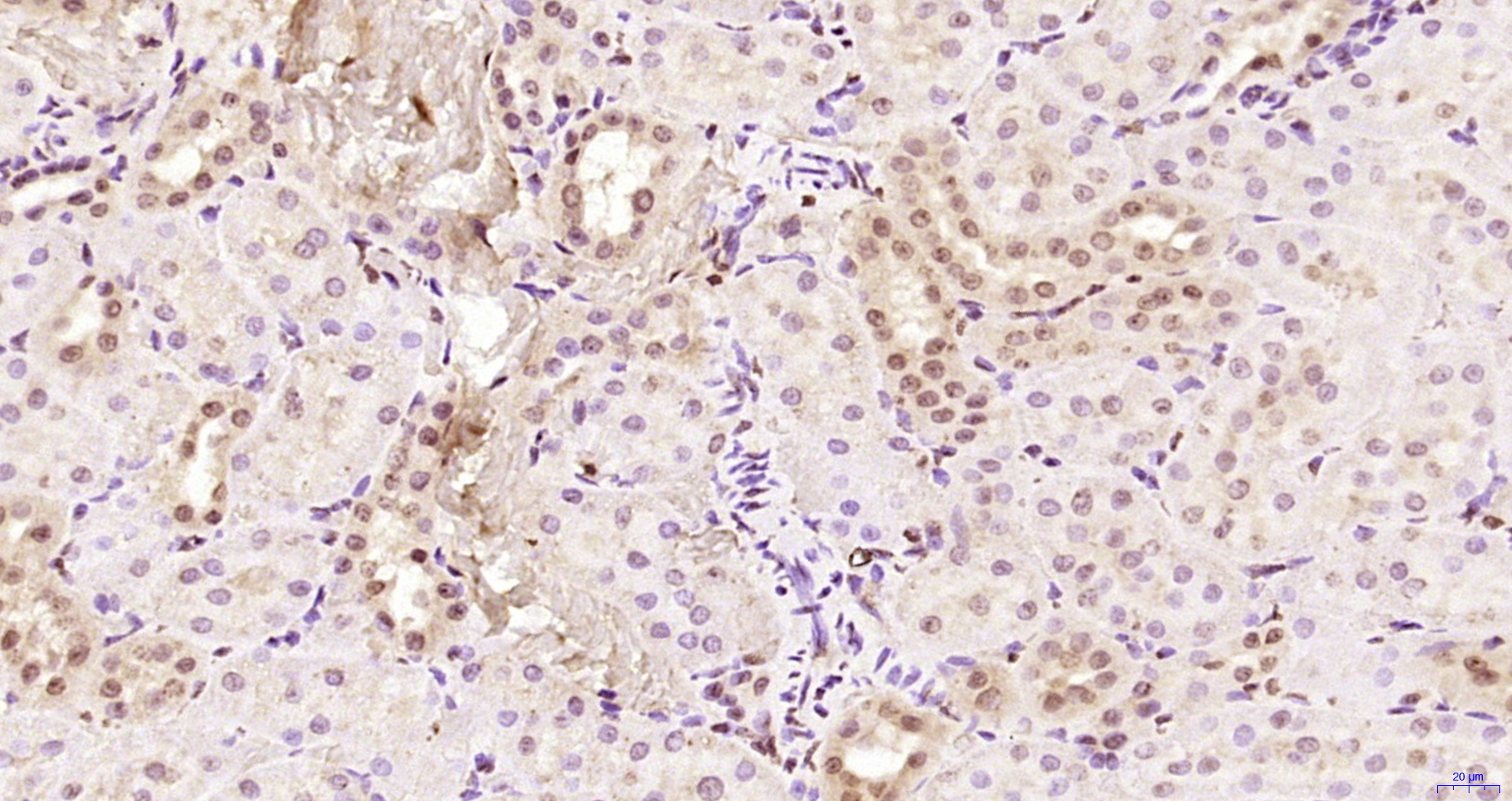 Paraformaldehyde-fixed, paraffin embedded Rat kidney; Antigen retrieval by boiling in sodium citrate buffer (pH6.0) for 15min; Block endogenous peroxidase by 3% hydrogen peroxide for 20 minutes; Blocking buffer (normal goat serum) at 37°C for 30min; Antibody incubation with KRG2/DDX11 Polyclonal Antibody, Unconjugated (bs-22217R) at 1:200 overnight at 4°C, DAB staining.