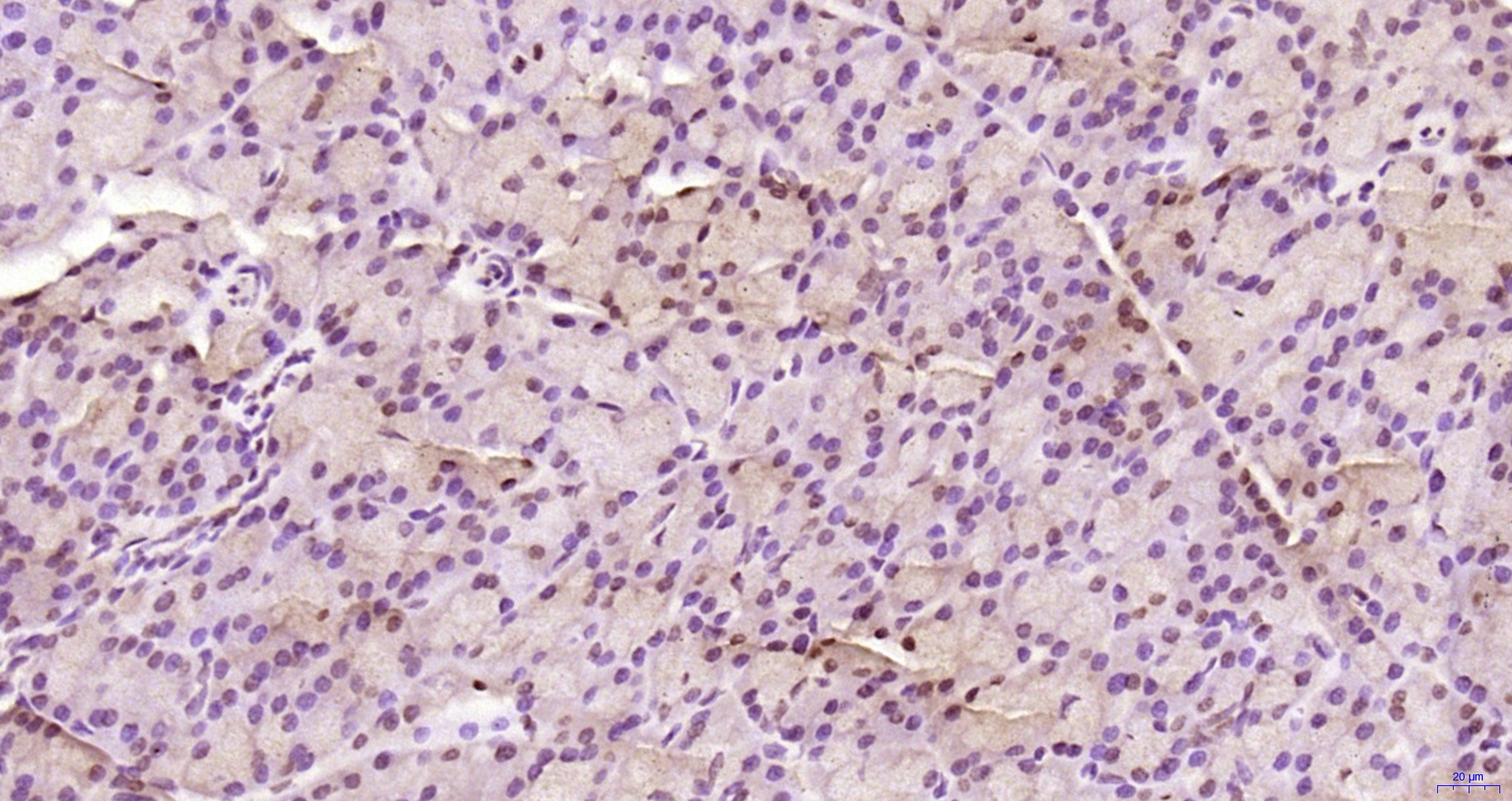 Paraformaldehyde-fixed, paraffin embedded Rat pancreas; Antigen retrieval by boiling in sodium citrate buffer (pH6.0) for 15min; Block endogenous peroxidase by 3% hydrogen peroxide for 20 minutes; Blocking buffer (normal goat serum) at 37°C for 30min; Antibody incubation with KRG2/DDX11 Polyclonal Antibody, Unconjugated (bs-22217R) at 1:200 overnight at 4°C, DAB staining.