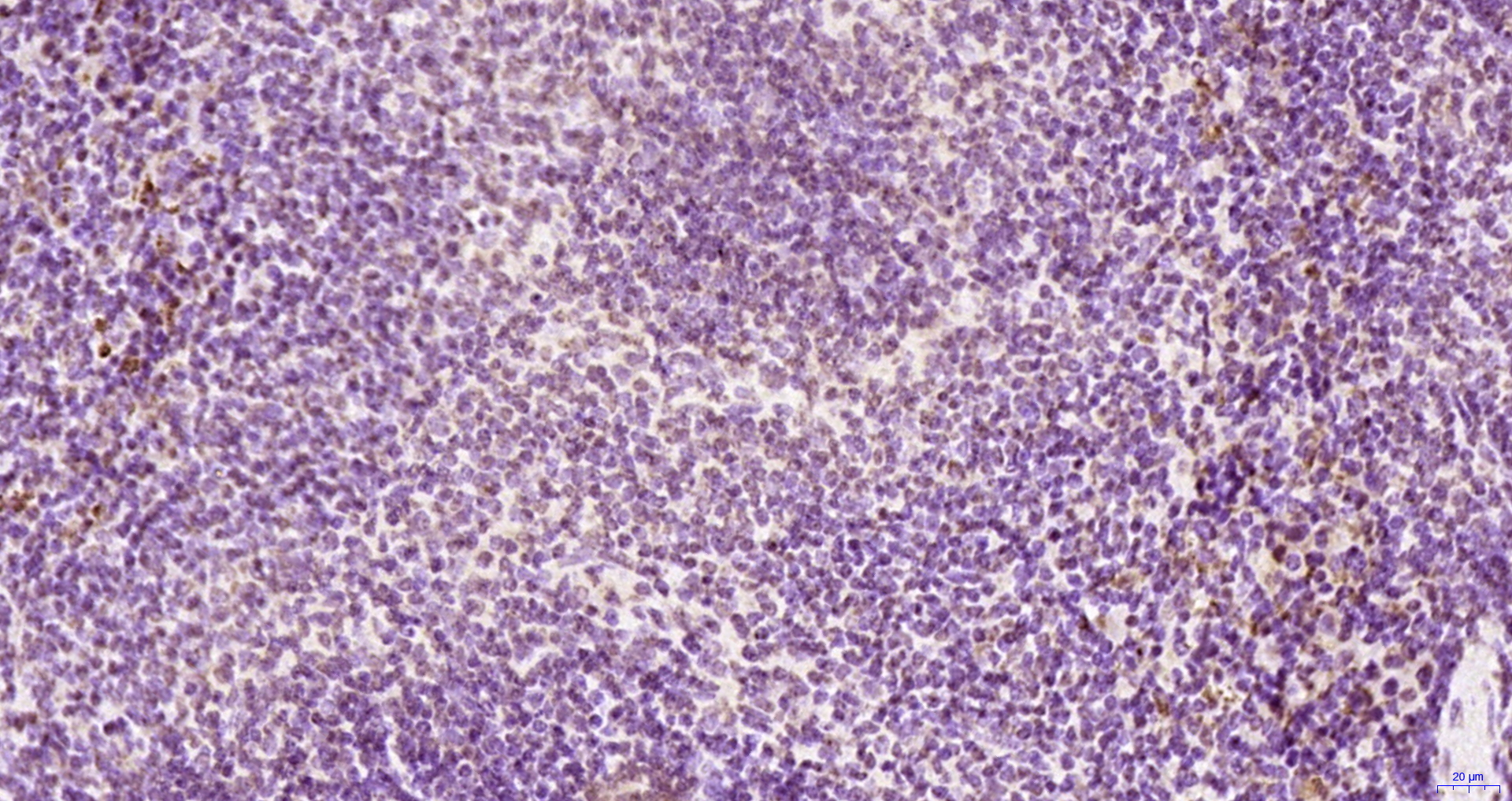 Paraformaldehyde-fixed, paraffin embedded Mouse spleen; Antigen retrieval by boiling in sodium citrate buffer (pH6.0) for 15min; Block endogenous peroxidase by 3% hydrogen peroxide for 20 minutes; Blocking buffer (normal goat serum) at 37°C for 30min; Antibody incubation with KRG2/DDX11 Polyclonal Antibody, Unconjugated (bs-22217R) at 1:200 overnight at 4°C, DAB staining.