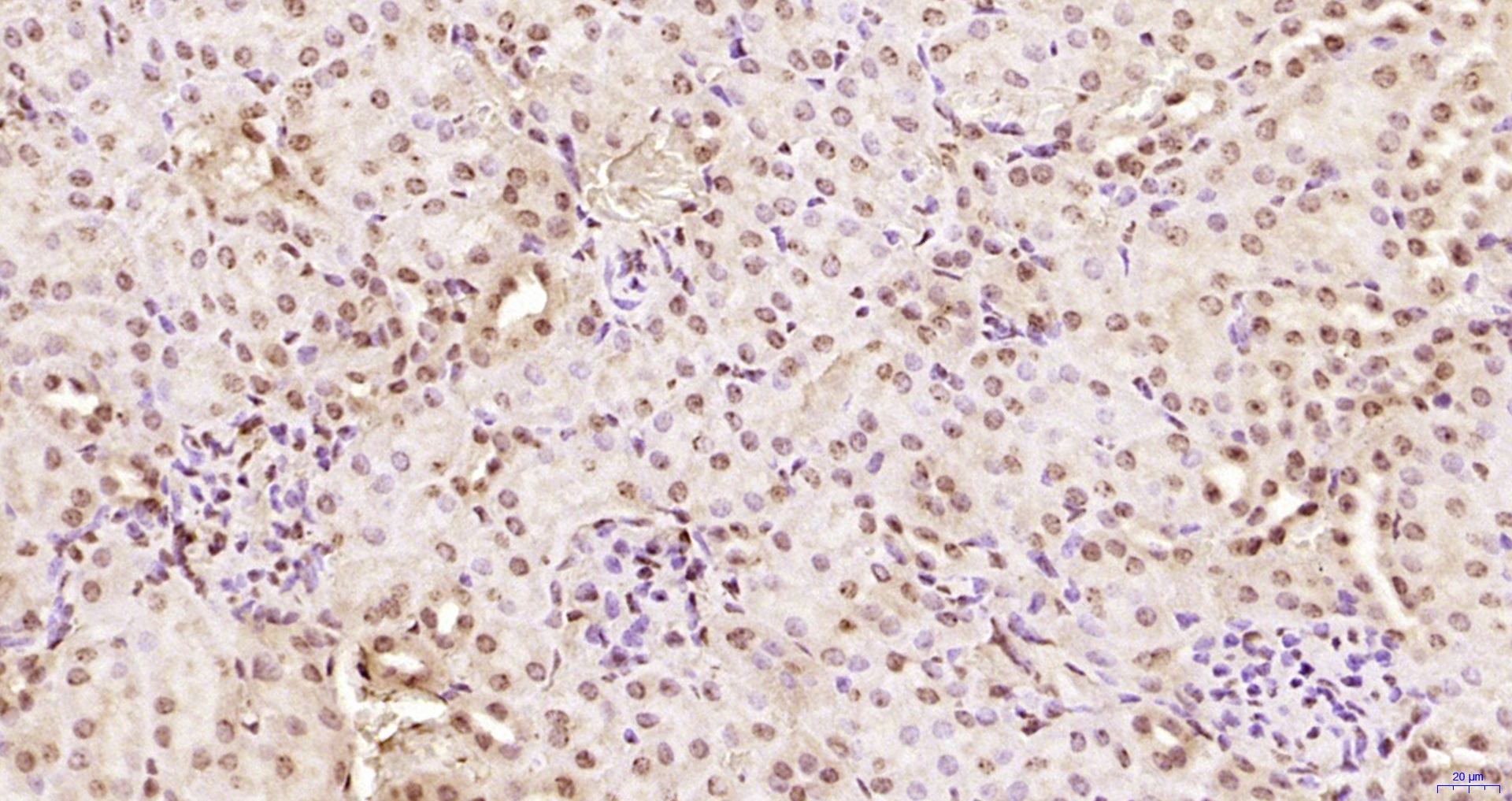 Paraformaldehyde-fixed, paraffin embedded Mouse kidney; Antigen retrieval by boiling in sodium citrate buffer (pH6.0) for 15min; Block endogenous peroxidase by 3% hydrogen peroxide for 20 minutes; Blocking buffer (normal goat serum) at 37°C for 30min; Antibody incubation with KRG2/DDX11 Polyclonal Antibody, Unconjugated (bs-22217R) at 1:200 overnight at 4°C, DAB staining.
