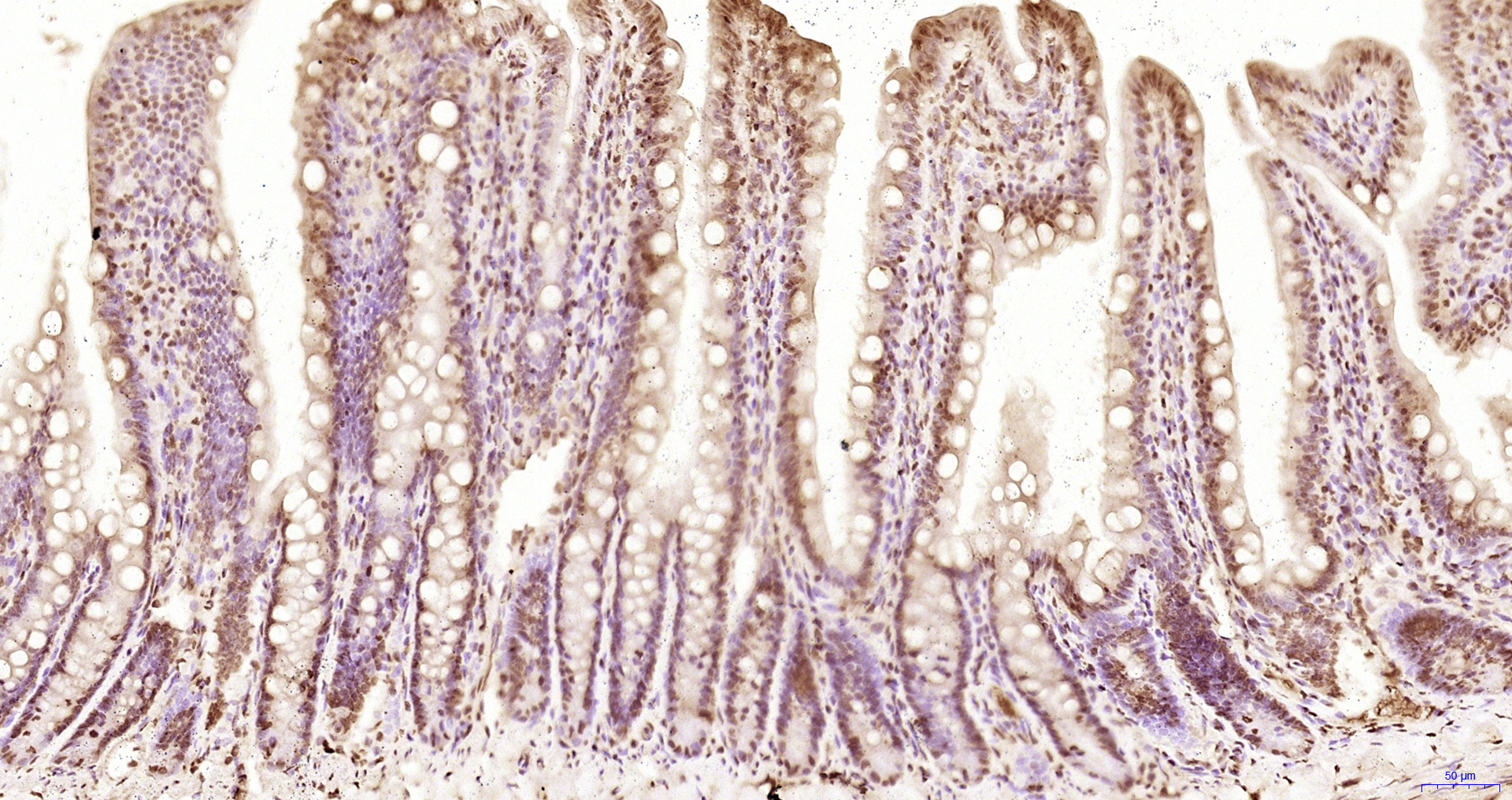 Paraformaldehyde-fixed, paraffin embedded Mouse intestine; Antigen retrieval by boiling in sodium citrate buffer (pH6.0) for 15min; Block endogenous peroxidase by 3% hydrogen peroxide for 20 minutes; Blocking buffer (normal goat serum) at 37°C for 30min; Antibody incubation with KRG2/DDX11 Polyclonal Antibody, Unconjugated (bs-22217R) at 1:200 overnight at 4°C, DAB staining.