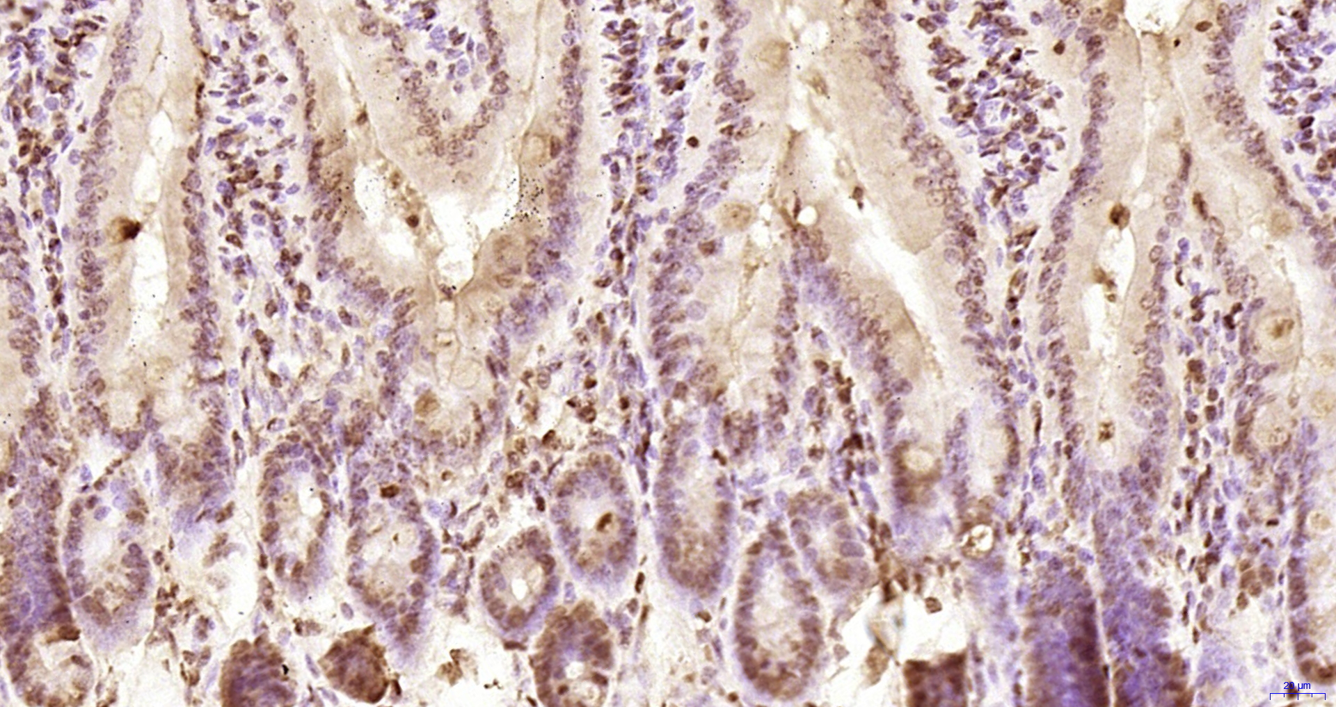 Paraformaldehyde-fixed, paraffin embedded Rat intestine; Antigen retrieval by boiling in sodium citrate buffer (pH6.0) for 15min; Block endogenous peroxidase by 3% hydrogen peroxide for 20 minutes; Blocking buffer (normal goat serum) at 37°C for 30min; Antibody incubation with KRG2/DDX11 Polyclonal Antibody, Unconjugated (bs-22217R) at 1:200 overnight at 4°C, DAB staining.