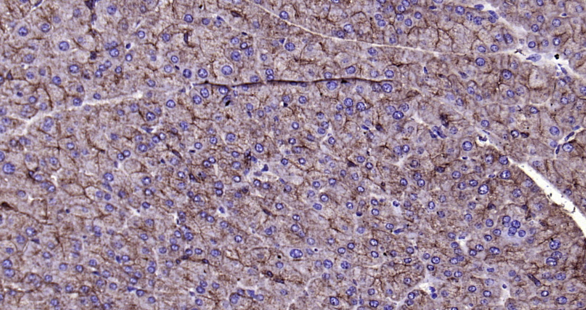 Paraformaldehyde-fixed, paraffin embedded Mouse pancreas; Antigen retrieval by boiling in sodium citrate buffer (pH6.0) for 15min; Block endogenous peroxidase by 3% hydrogen peroxide for 20 minutes; Blocking buffer (normal goat serum) at 37°C for 30min; Antibody incubation with CK18 Monoclonal Antibody, Unconjugated (bsm-33103M) at 1:200 overnight at 4°C, DAB staining.