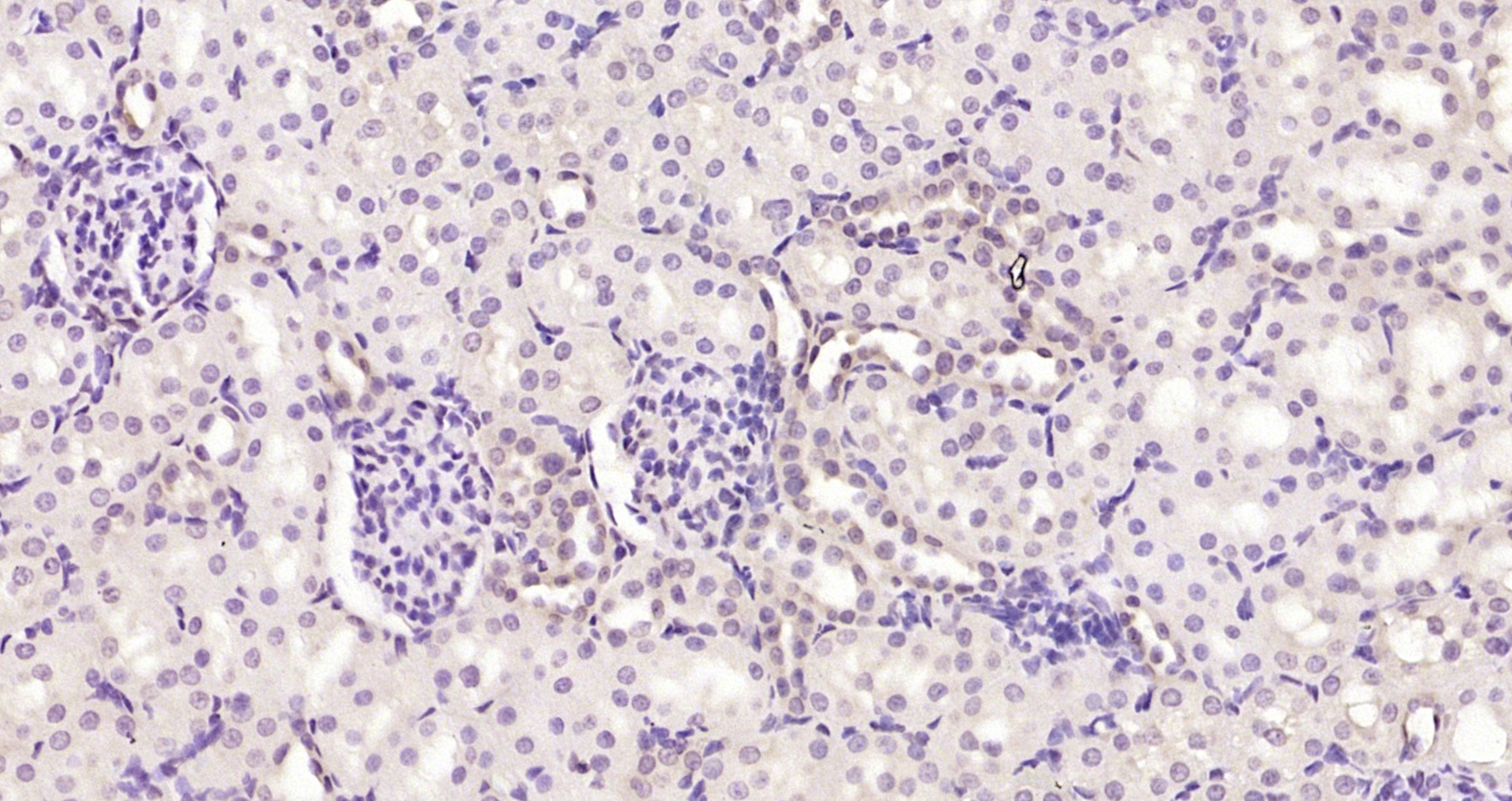 Paraformaldehyde-fixed, paraffin embedded Rat kidney; Antigen retrieval by boiling in sodium citrate buffer (pH6.0) for 15min; Block endogenous peroxidase by 3% hydrogen peroxide for 20 minutes; Blocking buffer (normal goat serum) at 37°C for 30min; Antibody incubation with _x000D_ Bcl2 Monoclonal Antibody, Unconjugated (bsm-33047M) at 1:200 overnight at 4°C, DAB staining.
