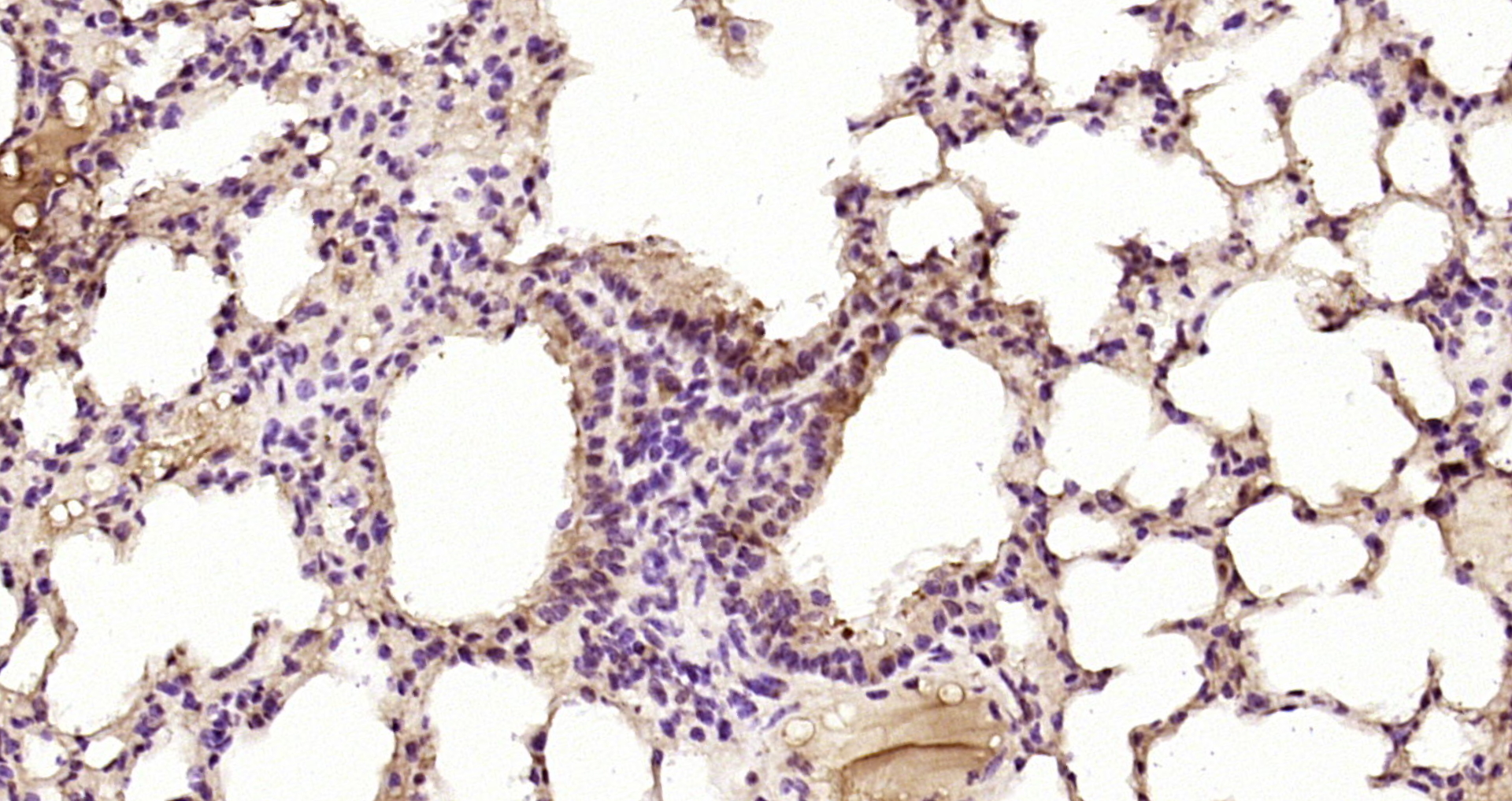 Paraformaldehyde-fixed, paraffin embedded Mouse lung; Antigen retrieval by boiling in sodium citrate buffer (pH6.0) for 15min; Block endogenous peroxidase by 3% hydrogen peroxide for 20 minutes; Blocking buffer (normal goat serum) at 37°C for 30min; Antibody incubation with STAT3 (5H4) Monoclonal Antibody, Unconjugated (bsm-33223M) at 1:200 overnight at 4°C, DAB staining.