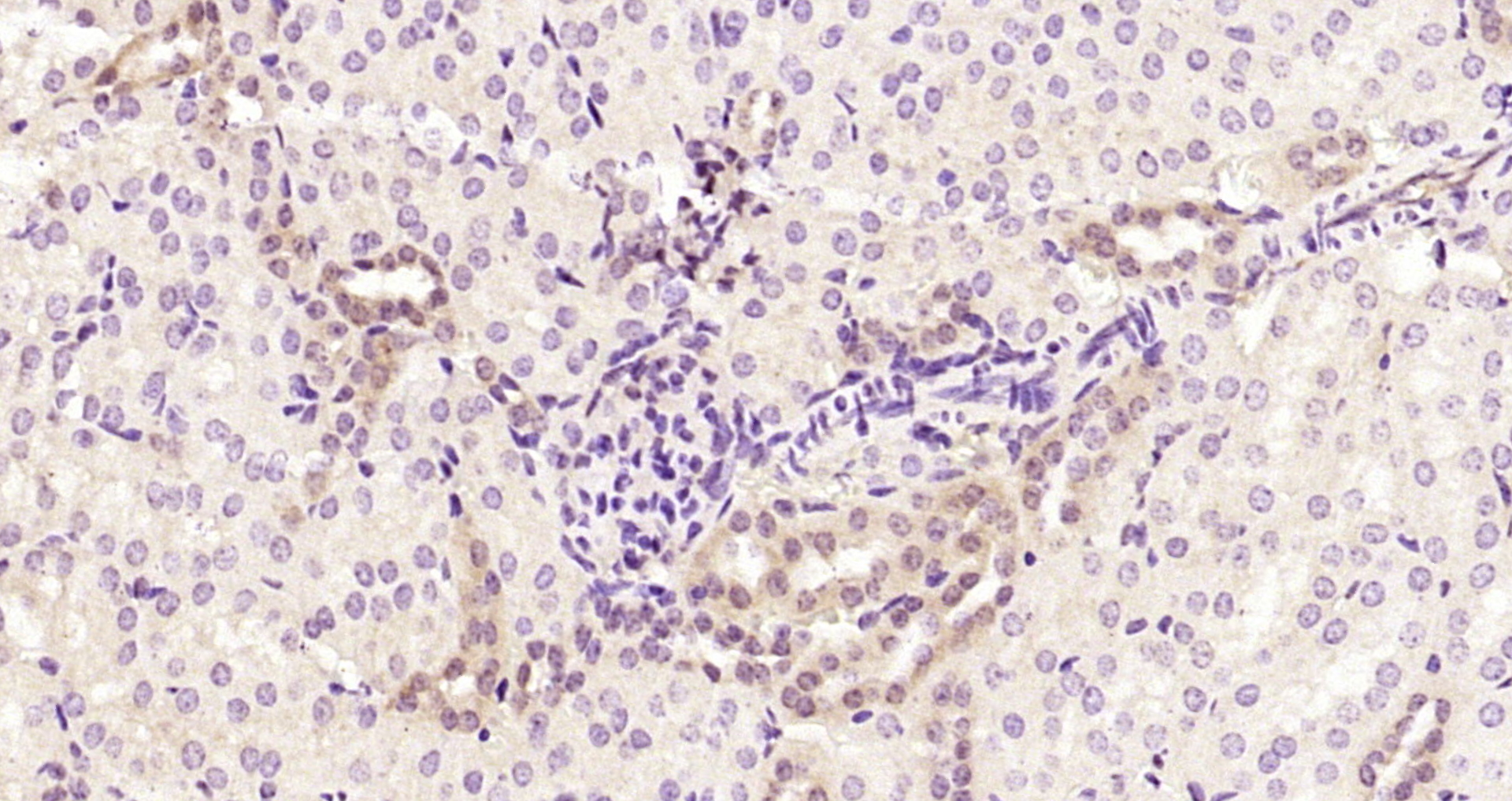 Paraformaldehyde-fixed, paraffin embedded Mouse kidney; Antigen retrieval by boiling in sodium citrate buffer (pH6.0) for 15min; Block endogenous peroxidase by 3% hydrogen peroxide for 20 minutes; Blocking buffer (normal goat serum) at 37°C for 30min; Antibody incubation with STAT3 (5H4) Monoclonal Antibody, Unconjugated (bsm-33223M) at 1:200 overnight at 4°C, DAB staining.