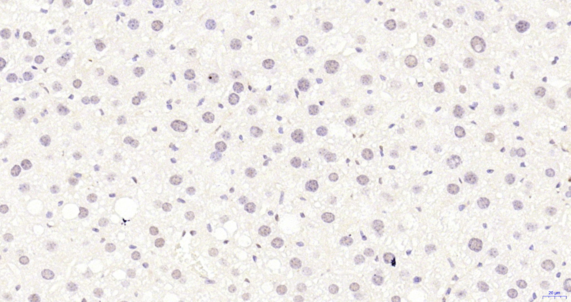 Paraformaldehyde-fixed, paraffin embedded Mouse liver; Antigen retrieval by boiling in sodium citrate buffer (pH6.0) for 15min; Block endogenous peroxidase by 3% hydrogen peroxide for 20 minutes; Blocking buffer (normal goat serum) at 37°C for 30min; Antibody incubation with HP1 gamma Monoclonal Antibody, Unconjugated (bsm-33375M) at 1:200 overnight at 4°C, DAB staining.