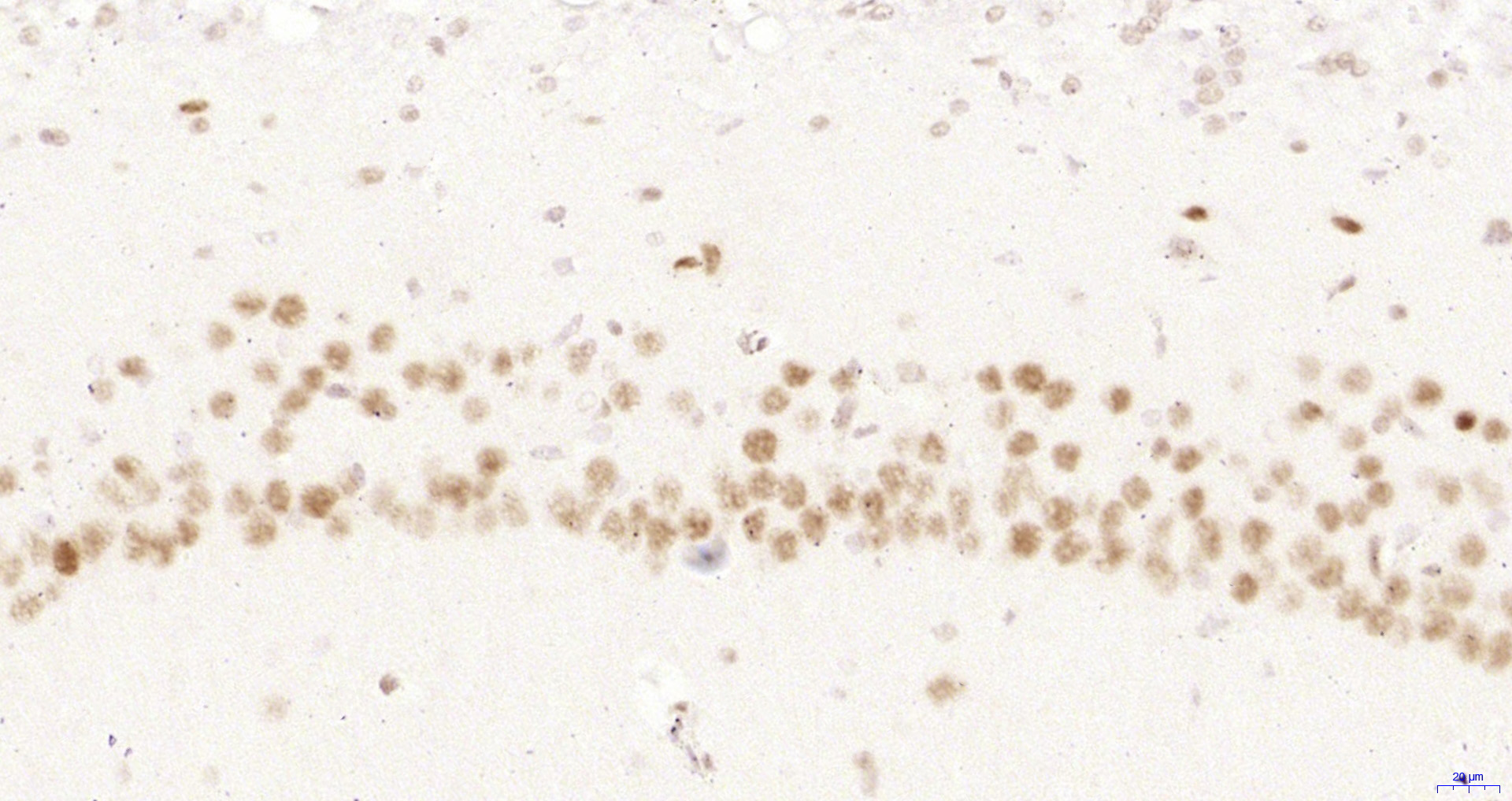 Paraformaldehyde-fixed, paraffin embedded Rat brain; Antigen retrieval by boiling in sodium citrate buffer (pH6.0) for 15min; Block endogenous peroxidase by 3% hydrogen peroxide for 20 minutes; Blocking buffer (normal goat serum) at 37°C for 30min; Antibody incubation with STAT3(S727) (4G1) Monoclonal Antibody, Unconjugated (bsm-52210R) at 1:200 overnight at 4°C, DAB staining.