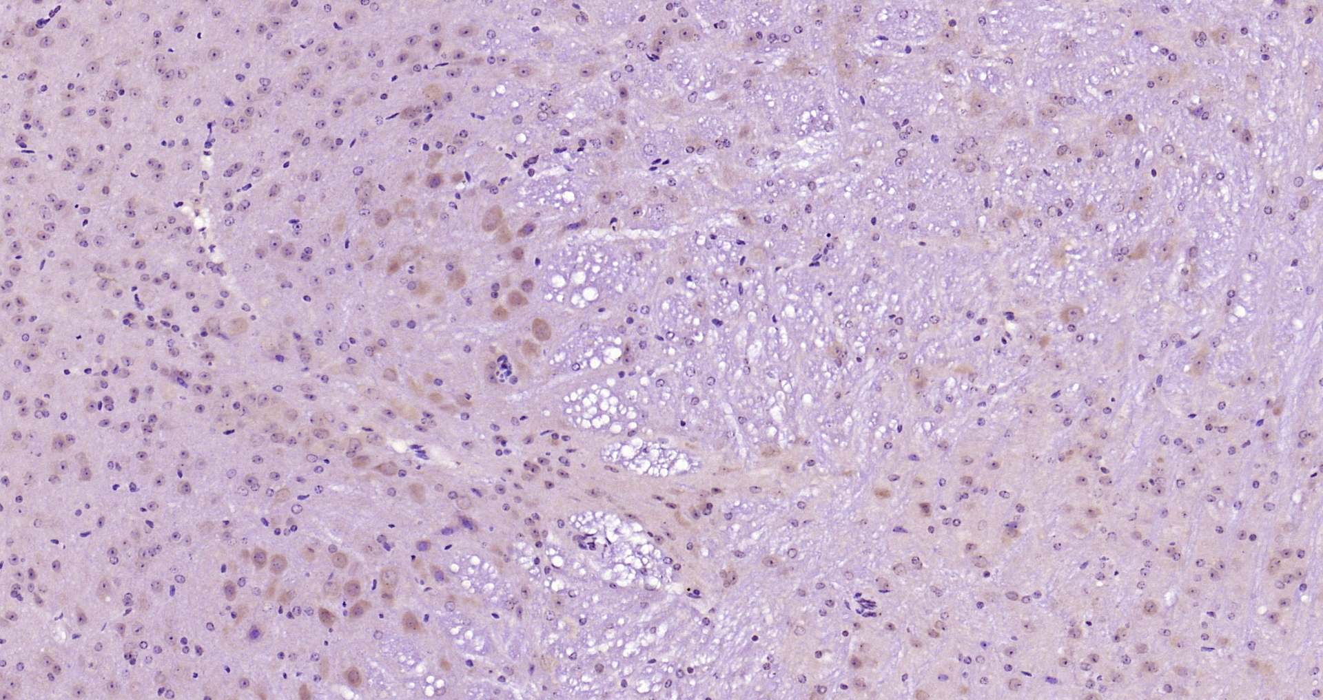 Paraformaldehyde-fixed, paraffin embedded Mouse brain; Antigen retrieval by boiling in sodium citrate buffer (pH6.0) for 15min; Block endogenous peroxidase by 3% hydrogen peroxide for 20 minutes; Blocking buffer (normal goat serum) at 37°C for 30min; Antibody incubation with PI3KCA(Tyr317) Polyclonal Antibody, Unconjugated (bs-5570R) at 1:200 overnight at 4°C, DAB staining.