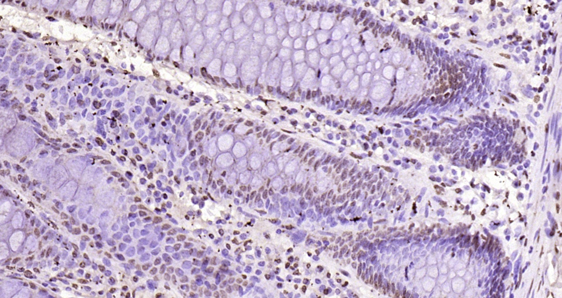 Paraformaldehyde-fixed, paraffin embedded Human colon; Antigen retrieval by boiling in sodium citrate buffer (pH6.0) for 15min; Block endogenous peroxidase by 3% hydrogen peroxide for 20 minutes; Blocking buffer (normal goat serum) at 37°C for 30min; Antibody incubation with Histone H3 Polyclonal Antibody, Unconjugated (bs-0349R) at 1:200 overnight at 4°C, DAB staining.