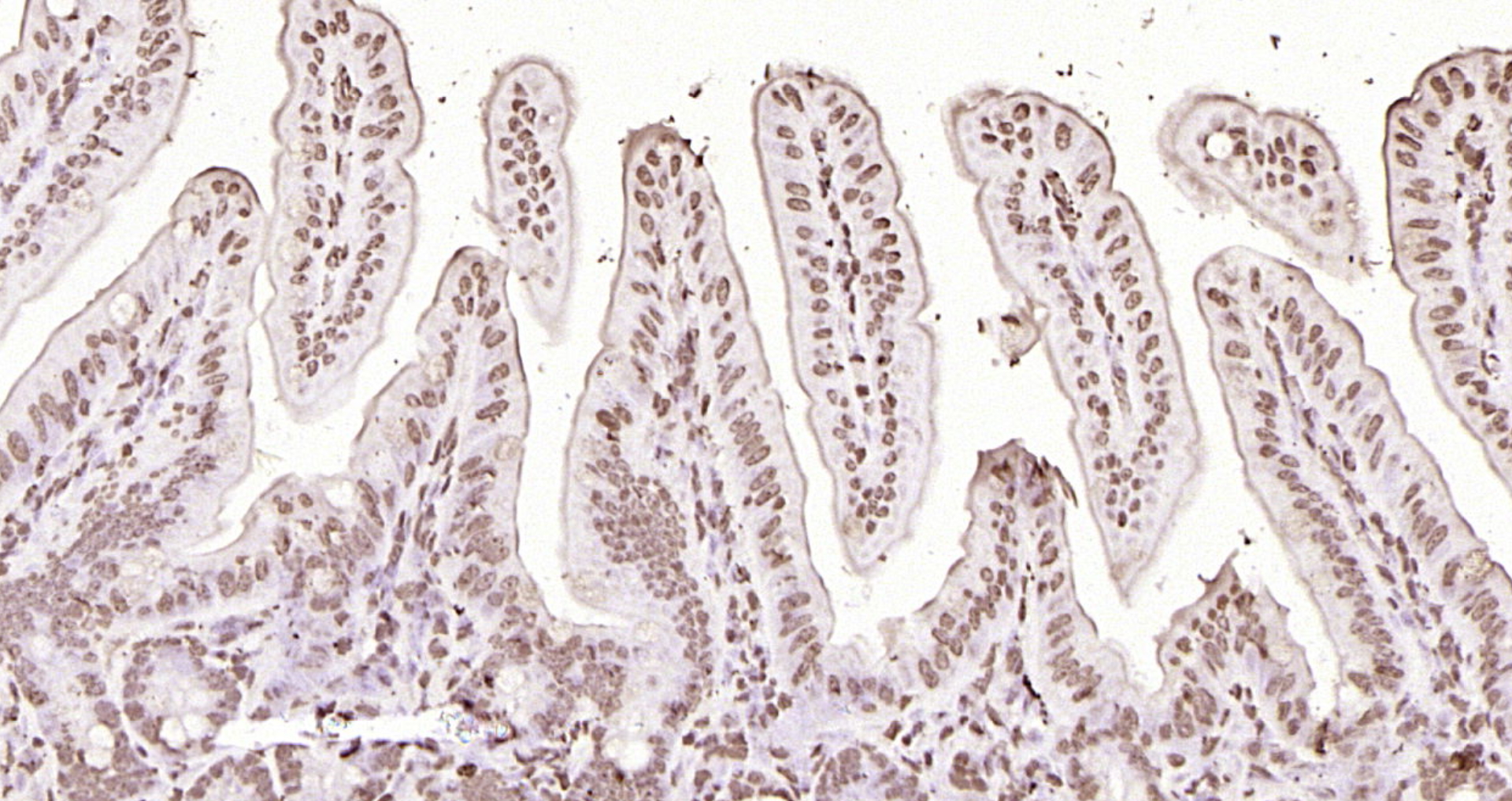 Paraformaldehyde-fixed, paraffin embedded Mouse intestine; Antigen retrieval by boiling in sodium citrate buffer (pH6.0) for 15min; Block endogenous peroxidase by 3% hydrogen peroxide for 20 minutes; Blocking buffer (normal goat serum) at 37°C for 30min; Antibody incubation with Histone H3 Polyclonal Antibody, Unconjugated (bs-0349R) at 1:200 overnight at 4°C, DAB staining.