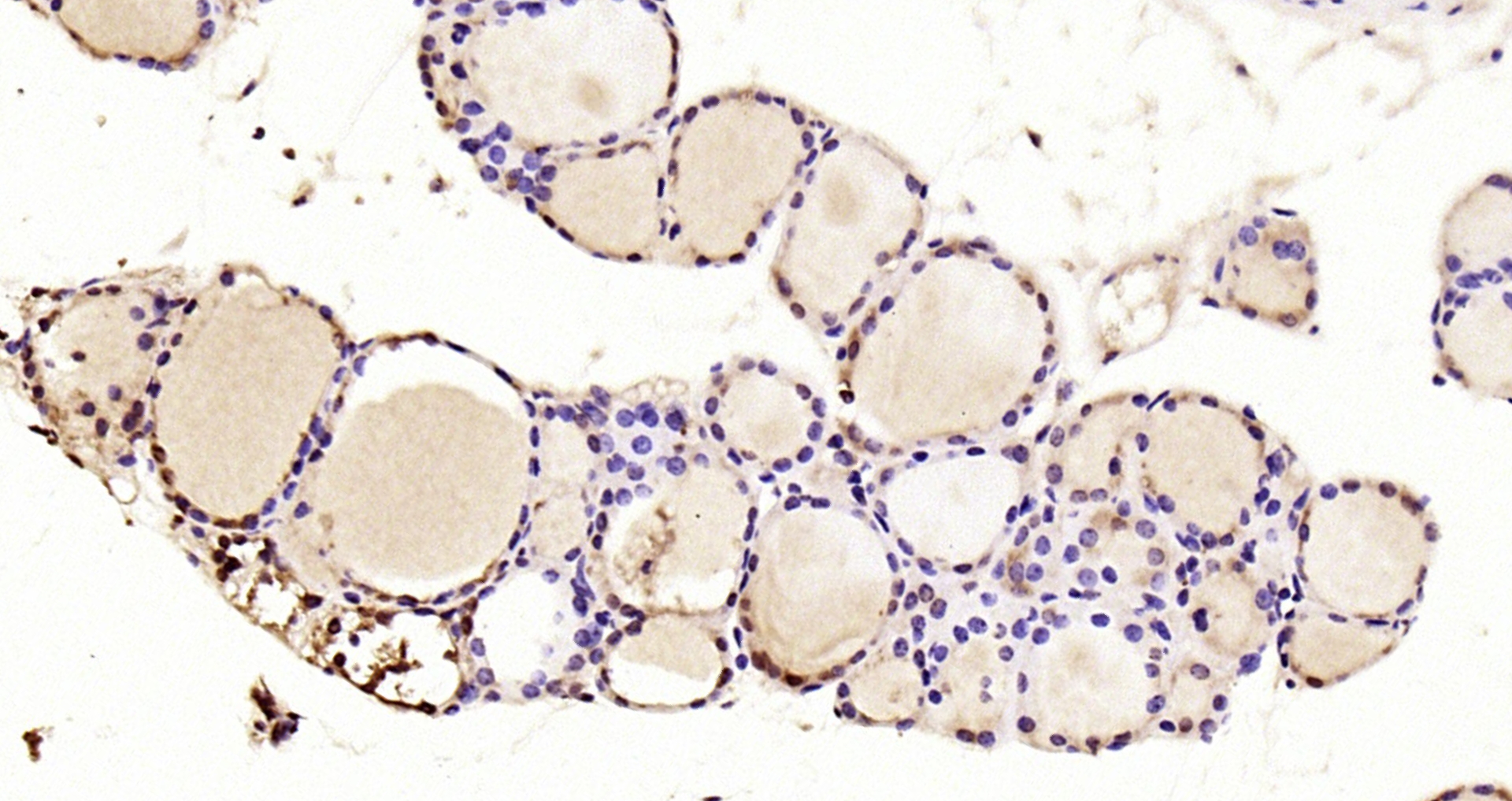 Paraformaldehyde-fixed, paraffin embedded Mouse thyroid; Antigen retrieval by boiling in sodium citrate buffer (pH6.0) for 15min; Block endogenous peroxidase by 3% hydrogen peroxide for 20 minutes; Blocking buffer (normal goat serum) at 37°C for 30min; Antibody incubation with PTEN Polyclonal Antibody, Unconjugated (bs-0686R) at 1:200 overnight at 4°C, DAB staining.