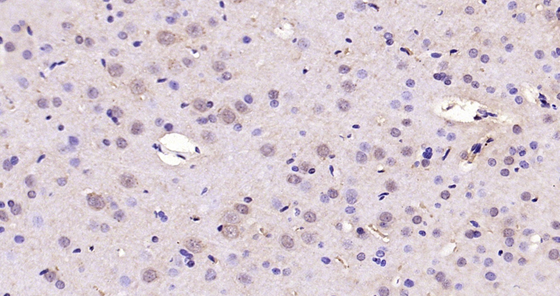 Paraformaldehyde-fixed, paraffin embedded Rat brain; Antigen retrieval by boiling in sodium citrate buffer (pH6.0) for 15min; Block endogenous peroxidase by 3% hydrogen peroxide for 20 minutes; Blocking buffer (normal goat serum) at 37°C for 30min; Antibody incubation with SREBP-1/2 Polyclonal Antibody, Unconjugated (bs-1402R) at 1:200 overnight at 4°C, DAB staining.