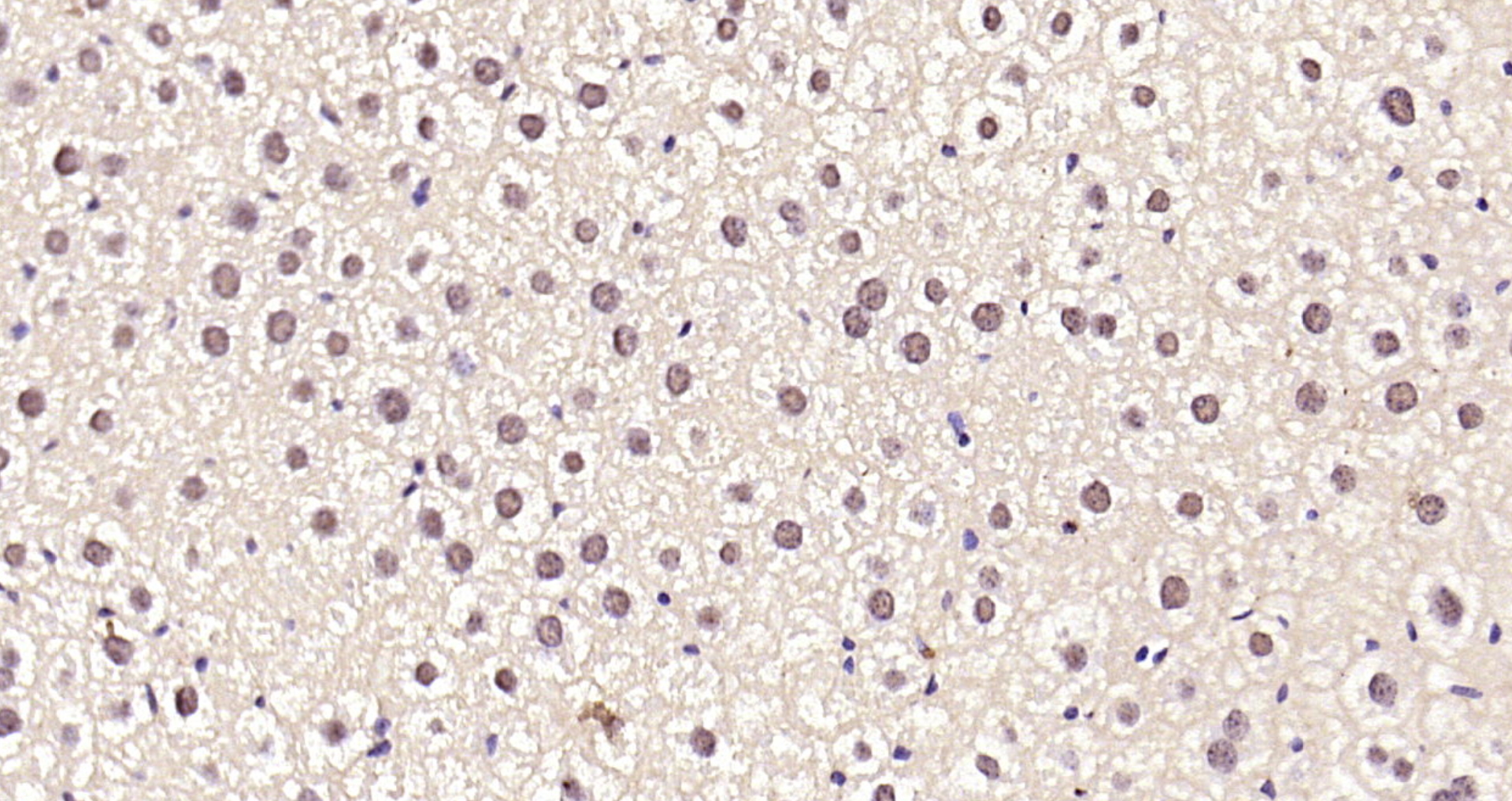 Paraformaldehyde-fixed, paraffin embedded Mouse liver; Antigen retrieval by boiling in sodium citrate buffer (pH6.0) for 15min; Block endogenous peroxidase by 3% hydrogen peroxide for 20 minutes; Blocking buffer (normal goat serum) at 37°C for 30min; Antibody incubation with SREBP-1/2 Polyclonal Antibody, Unconjugated (bs-1402R) at 1:200 overnight at 4°C, DAB staining.