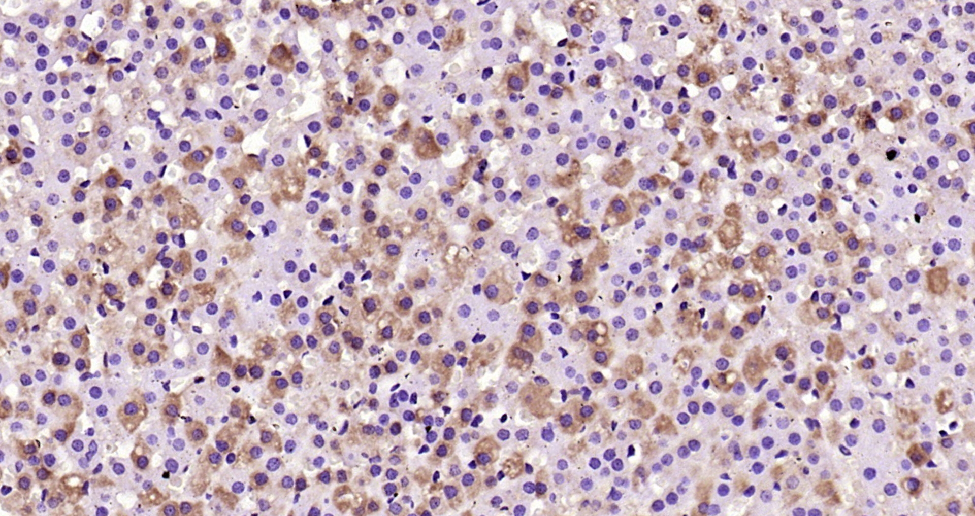 Paraformaldehyde-fixed, paraffin embedded Rat adrenal gland; Antigen retrieval by boiling in sodium citrate buffer (pH6.0) for 15min; Block endogenous peroxidase by 3% hydrogen peroxide for 20 minutes; Blocking buffer (normal goat serum) at 37°C for 30min; Antibody incubation with _x000D_ IL-6R Beta/CD130/gp130 Polyclonal Antibody, Unconjugated (bs-1459R) at 1:200 overnight at 4°C, DAB staining.