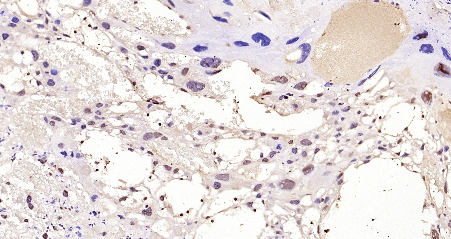 Paraformaldehyde-fixed, paraffin embedded Rat placenta; Antigen retrieval by boiling in sodium citrate buffer (pH6.0) for 15min; Block endogenous peroxidase by 3% hydrogen peroxide for 20 minutes; Blocking buffer (normal goat serum) at 37°C for 30min; Antibody incubation with TWIST1/2 Polyclonal Antibody, Unconjugated (bs-2441R) at 1:200 overnight at 4°C, DAB staining.