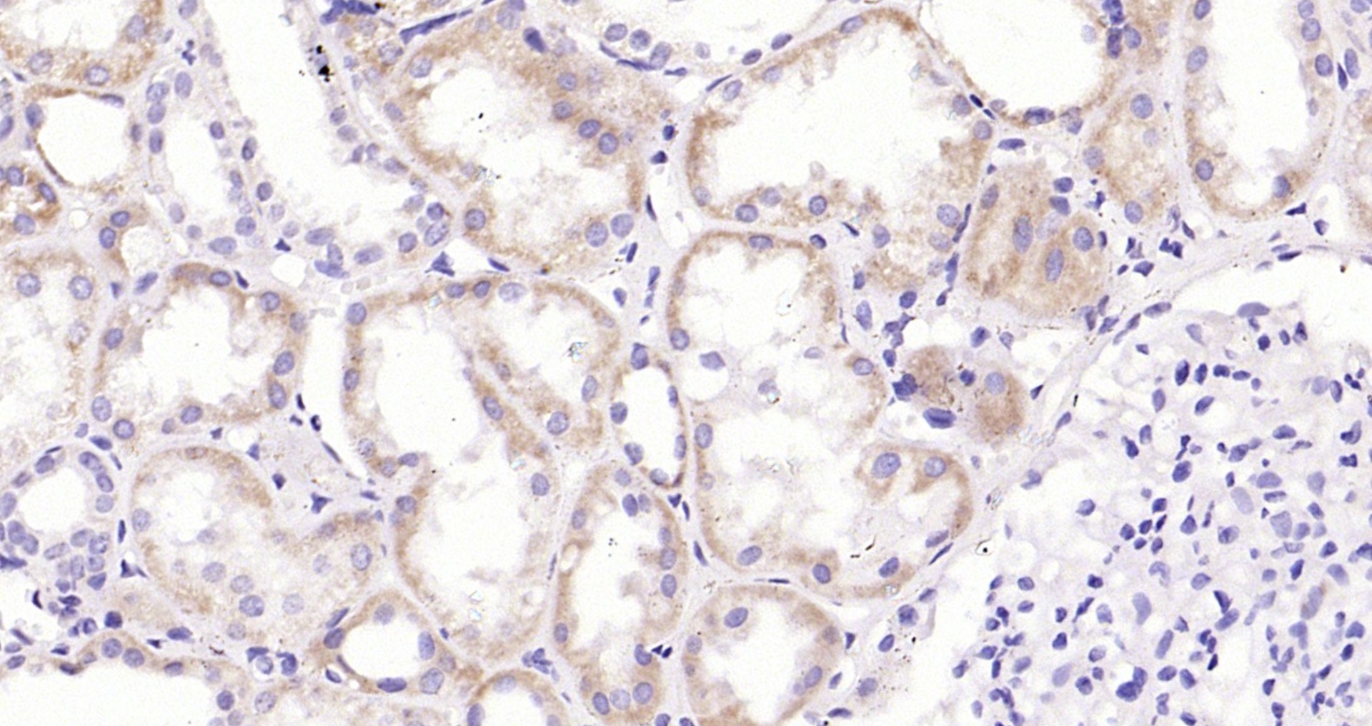 Paraformaldehyde-fixed, paraffin embedded Human kidney; Antigen retrieval by boiling in sodium citrate buffer (pH6.0) for 15min; Block endogenous peroxidase by 3% hydrogen peroxide for 20 minutes; Blocking buffer (normal goat serum) at 37°C for 30min; Antibody incubation with CRP(C11F2) Monoclonal Antibody, Unconjugated (bsm-0391M) at 1:2000 overnight at 4°C, DAB staining.