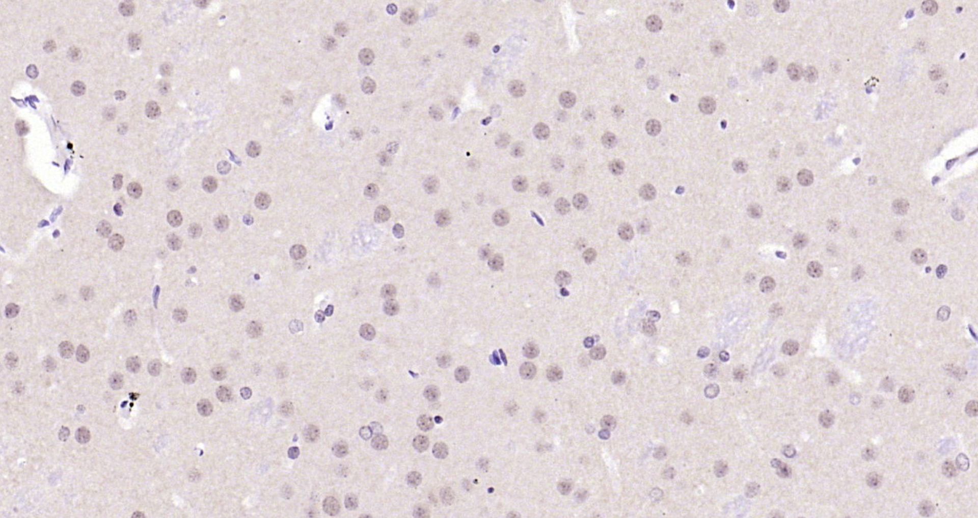 Paraformaldehyde-fixed, paraffin embedded Rat brain; Antigen retrieval by boiling in sodium citrate buffer (pH6.0) for 15min; Block endogenous peroxidase by 3% hydrogen peroxide for 20 minutes; Blocking buffer (normal goat serum) at 37°C for 30min; Antibody incubation with AKT1(T450) (4A3) Monoclonal Antibody, Unconjugated (bsm-52131R) at 1:200 overnight at 4°C, DAB staining.