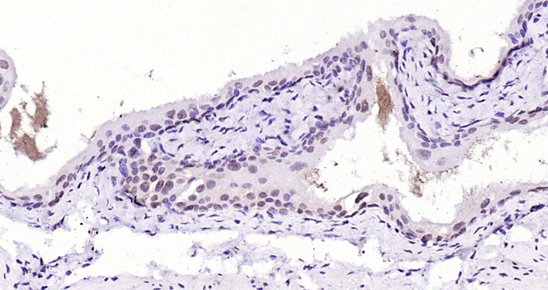 Paraformaldehyde-fixed, paraffin embedded Rat bladder; Antigen retrieval by boiling in sodium citrate buffer (pH6.0) for 15min; Block endogenous peroxidase by 3% hydrogen peroxide for 20 minutes; Blocking buffer (normal goat serum) at 37°C for 30min; Antibody incubation with AKT1(T450) (4A3) Monoclonal Antibody, Unconjugated (bsm-52131R) at 1:200 overnight at 4°C, DAB staining.
