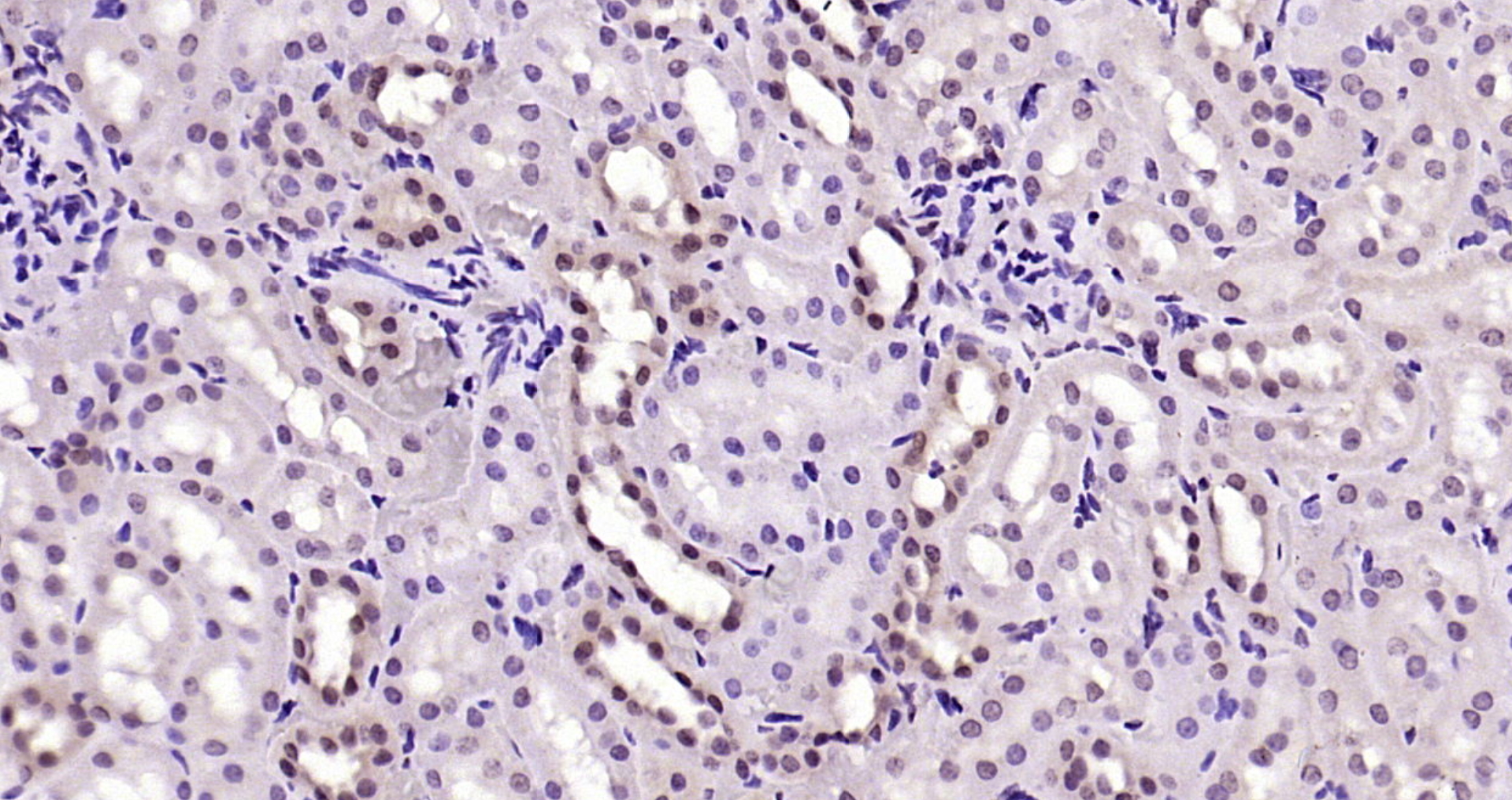 Paraformaldehyde-fixed, paraffin embedded Rat kidney; Antigen retrieval by boiling in sodium citrate buffer (pH6.0) for 15min; Block endogenous peroxidase by 3% hydrogen peroxide for 20 minutes; Blocking buffer (normal goat serum) at 37°C for 30min; Antibody incubation with AKT1(T450) (4A3) Monoclonal Antibody, Unconjugated (bsm-52131R) at 1:200 overnight at 4°C, DAB staining.