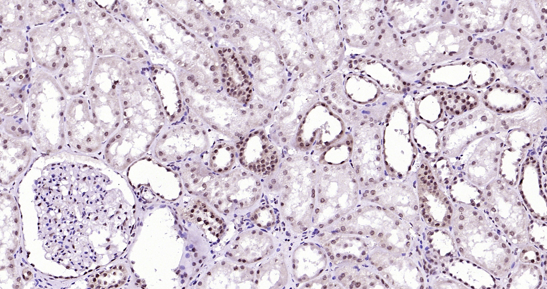 Paraformaldehyde-fixed, paraffin embedded Human kidney; Antigen retrieval by boiling in sodium citrate buffer (pH6.0) for 15min; Block endogenous peroxidase by 3% hydrogen peroxide for 20 minutes; Blocking buffer (normal goat serum) at 37°C for 30min; Antibody incubation with AKT1(T450) (4A3) Monoclonal Antibody, Unconjugated (bsm-52131R) at 1:200 overnight at 4°C, DAB staining.