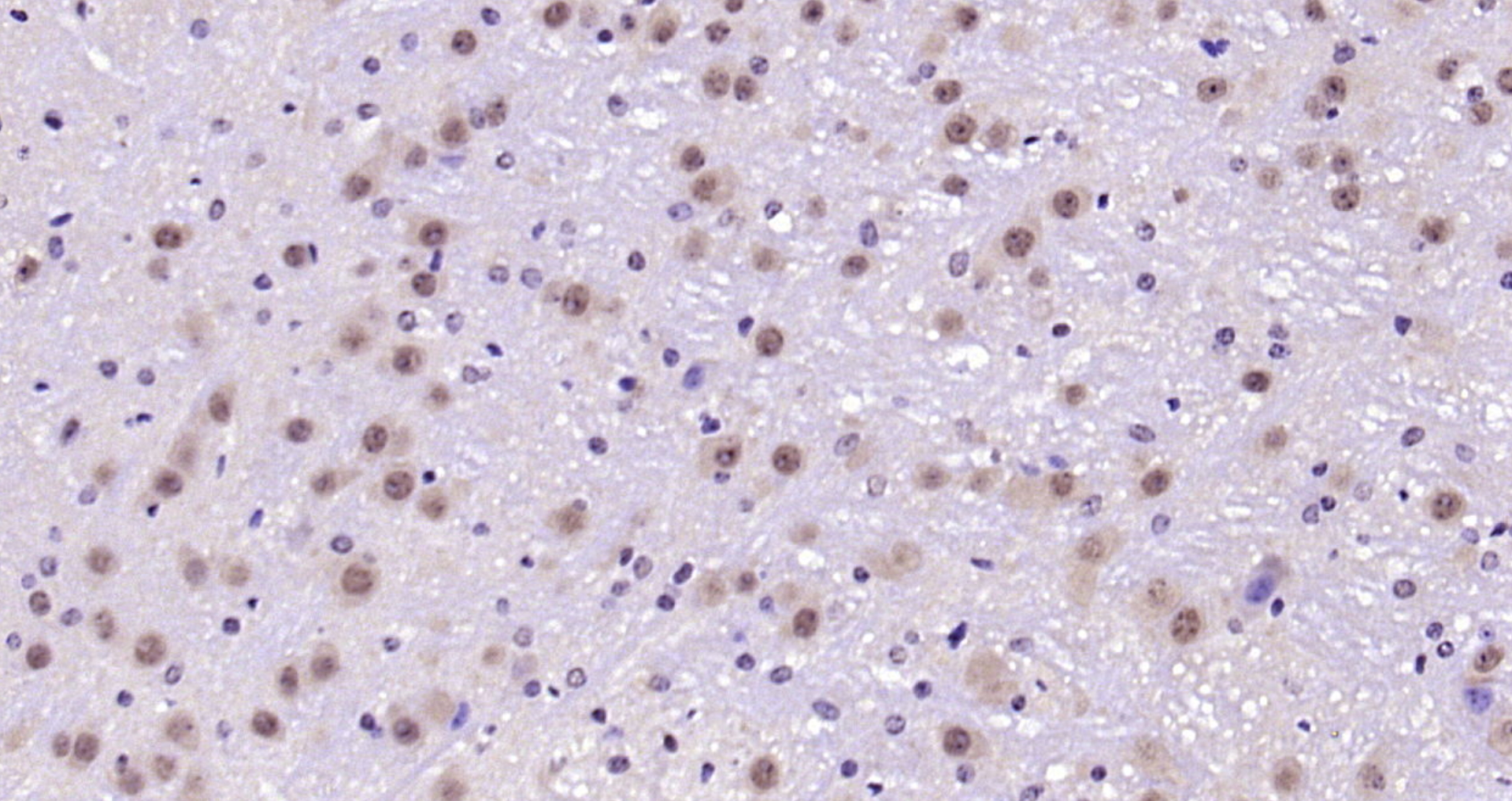 Paraformaldehyde-fixed, paraffin embedded Mouse brain; Antigen retrieval by boiling in sodium citrate buffer (pH6.0) for 15min; Block endogenous peroxidase by 3% hydrogen peroxide for 20 minutes; Blocking buffer (normal goat serum) at 37°C for 30min; Antibody incubation with AKT1(T450) (4A3) Monoclonal Antibody, Unconjugated (bsm-52131R) at 1:200 overnight at 4°C, DAB staining.