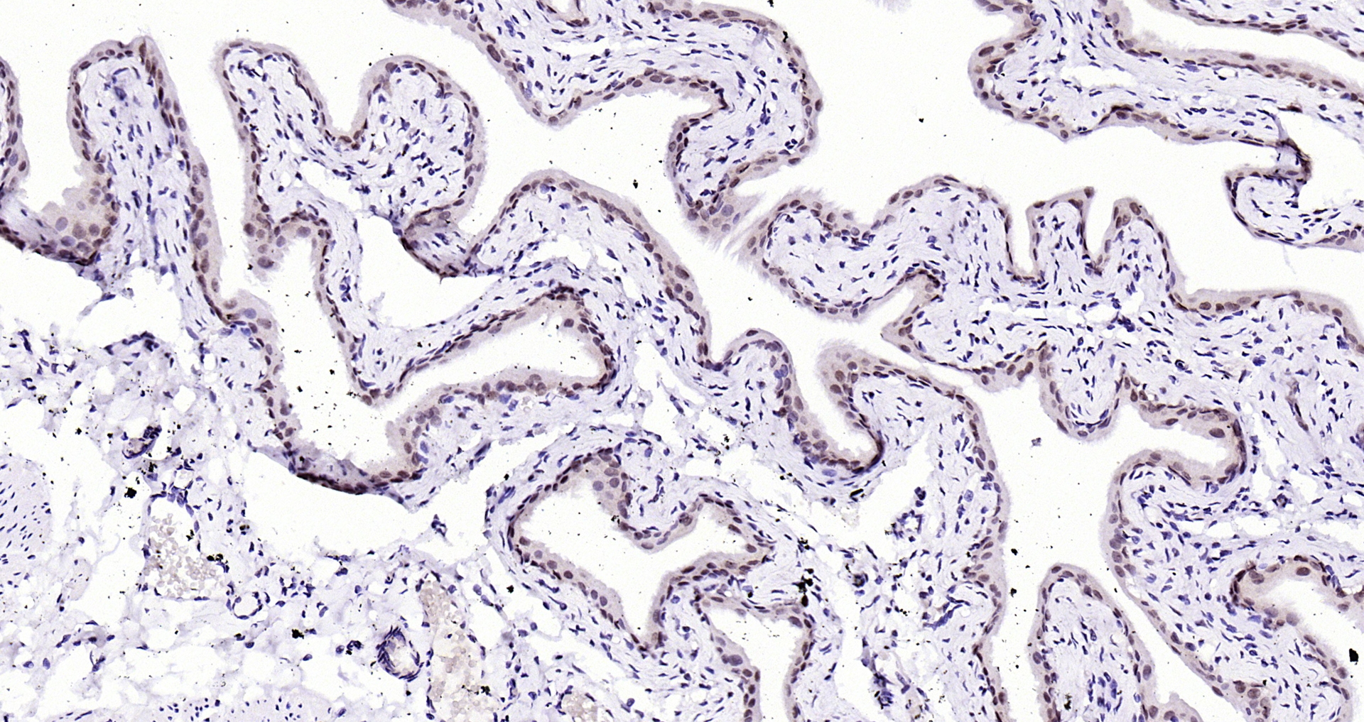 Paraformaldehyde-fixed, paraffin embedded Mouse bladder; Antigen retrieval by boiling in sodium citrate buffer (pH6.0) for 15min; Block endogenous peroxidase by 3% hydrogen peroxide for 20 minutes; Blocking buffer (normal goat serum) at 37°C for 30min; Antibody incubation with AKT1(T450) (4A3) Monoclonal Antibody, Unconjugated (bsm-52131R) at 1:200 overnight at 4°C, DAB staining.